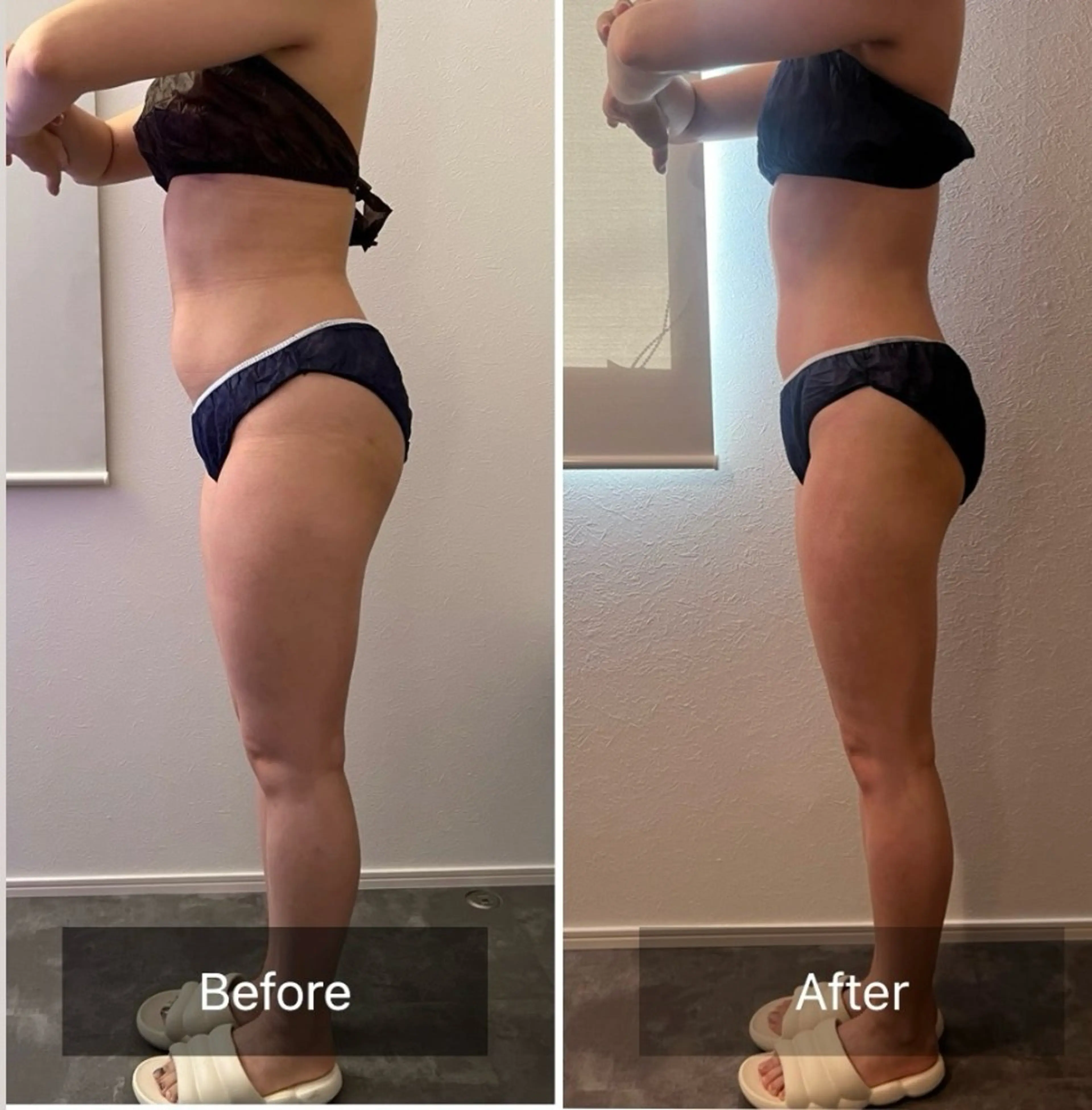 本気で痩せたい方へ 痩身専門サロンのエステ・リラクイメージ