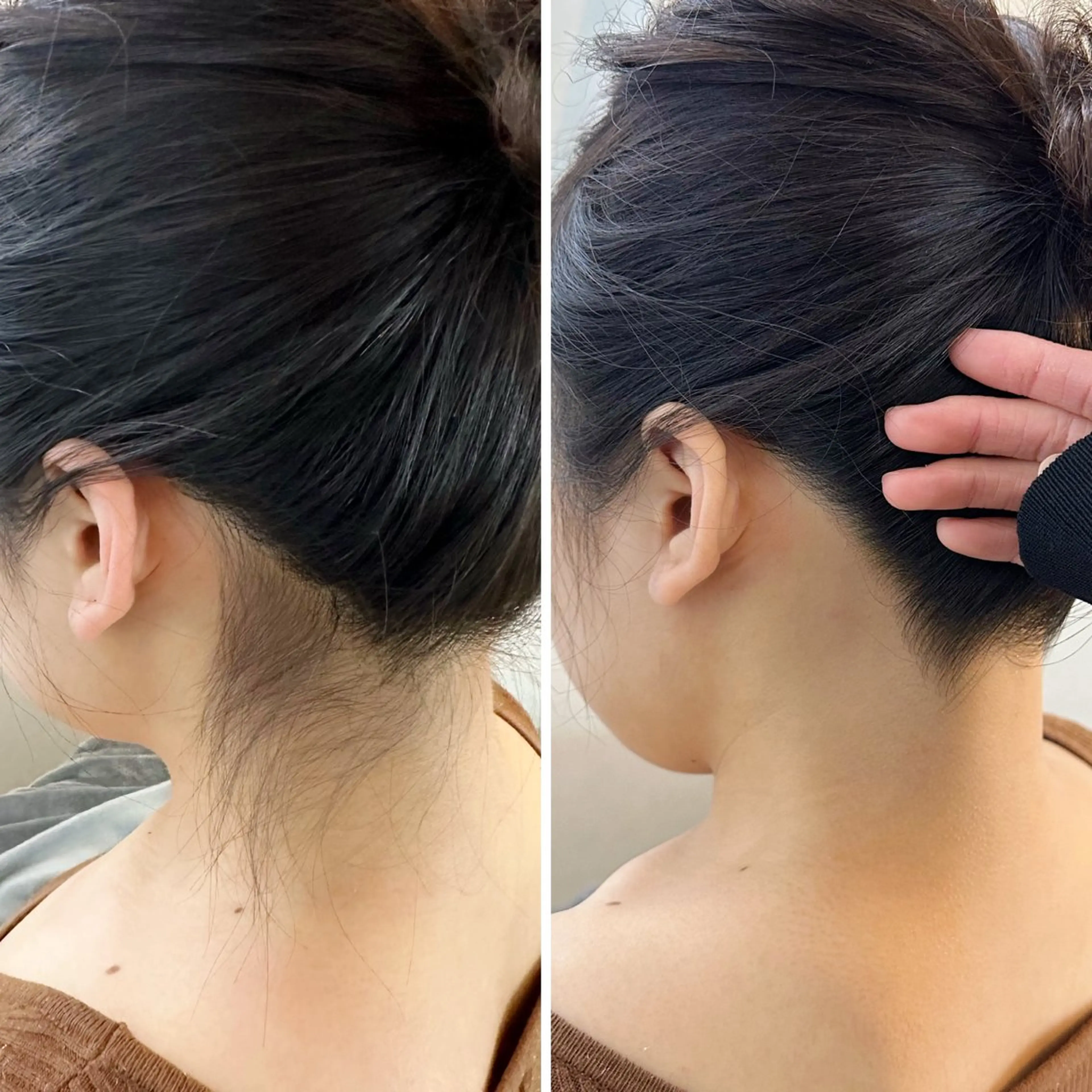 脱毛 うなじ脱毛/美肌脱毛 LABELのエステ・リラクイメージ