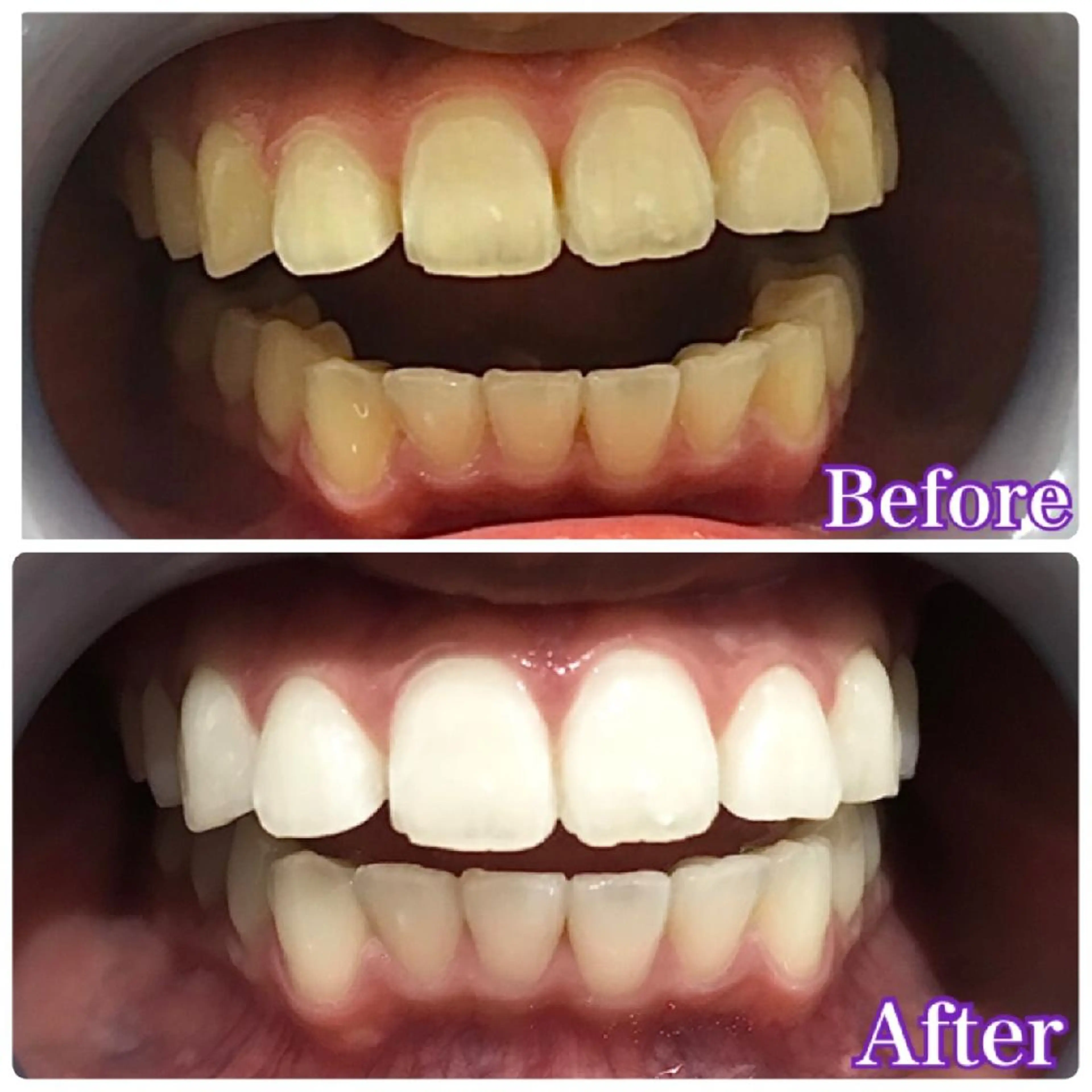 LOVE ホワイトニング渋谷のその他イメージ