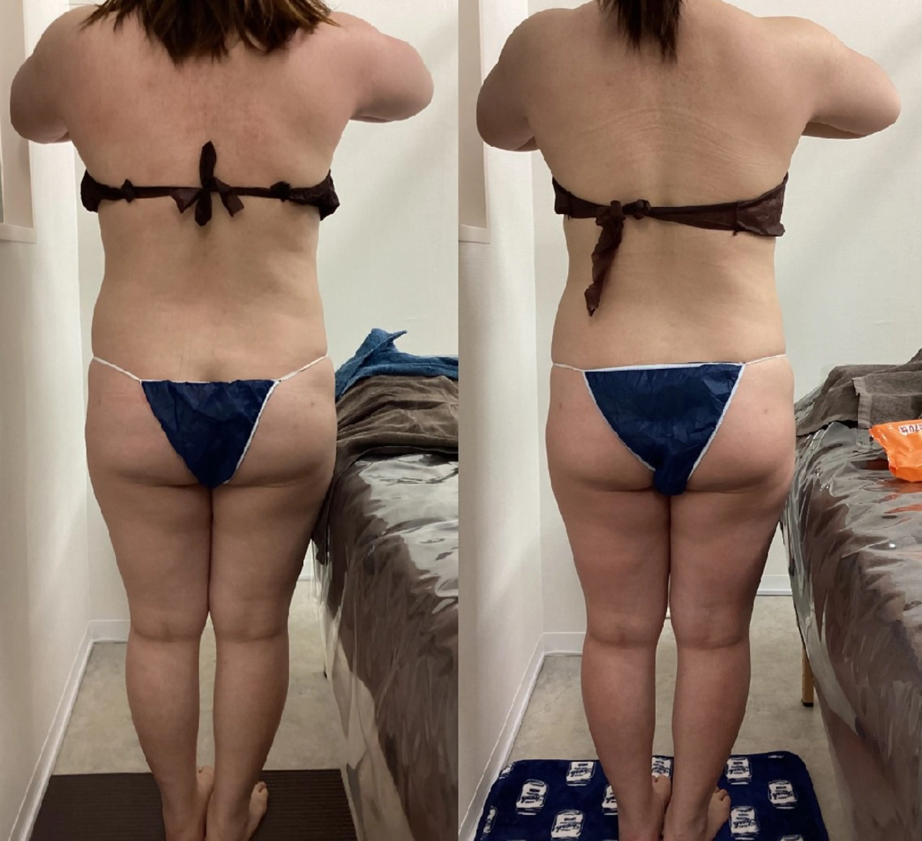 美肌専門サロン RUBONのエステ・リラクイメージ