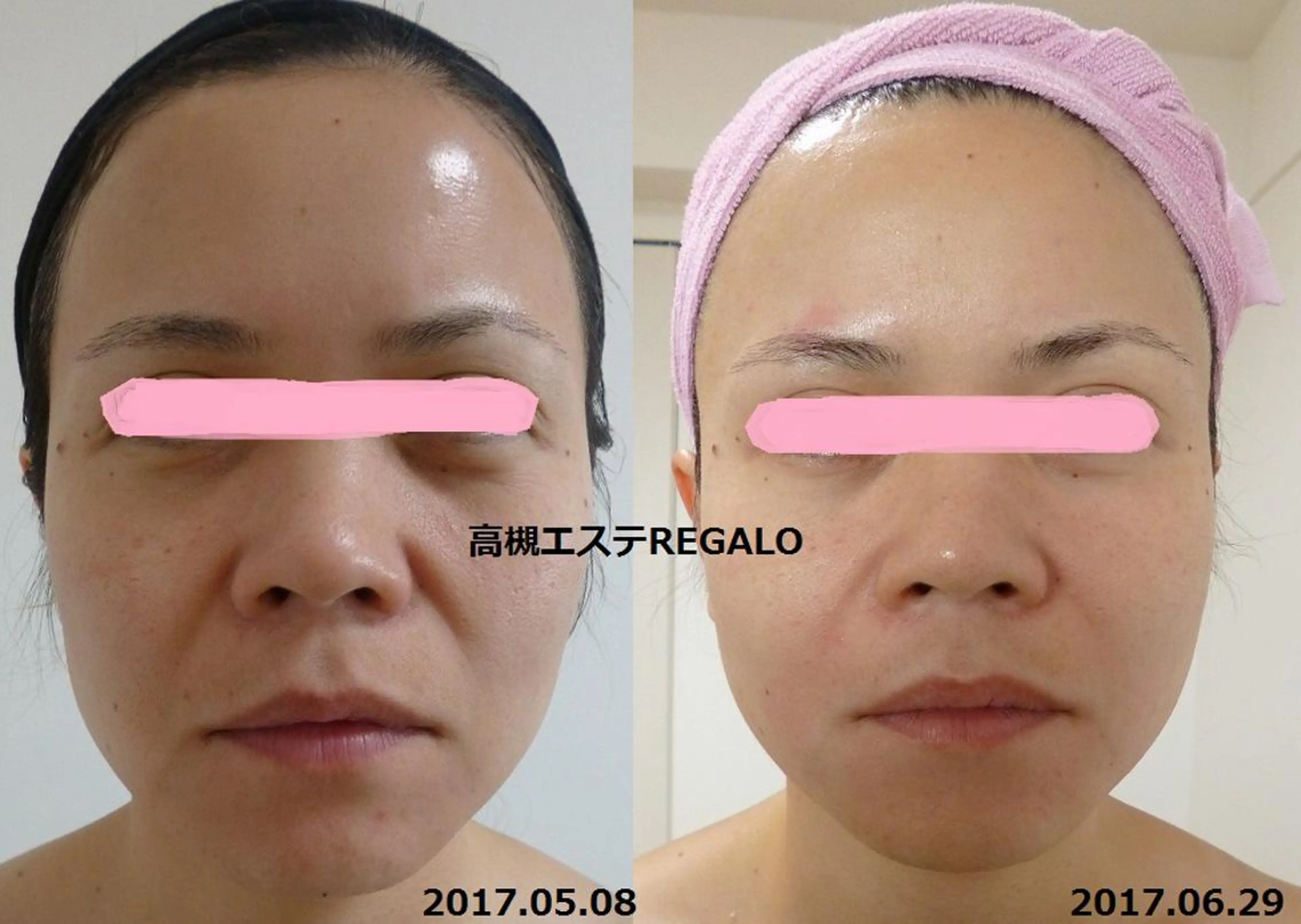 REGALO所属・矢野 さやかのエステ・リラクイメージ