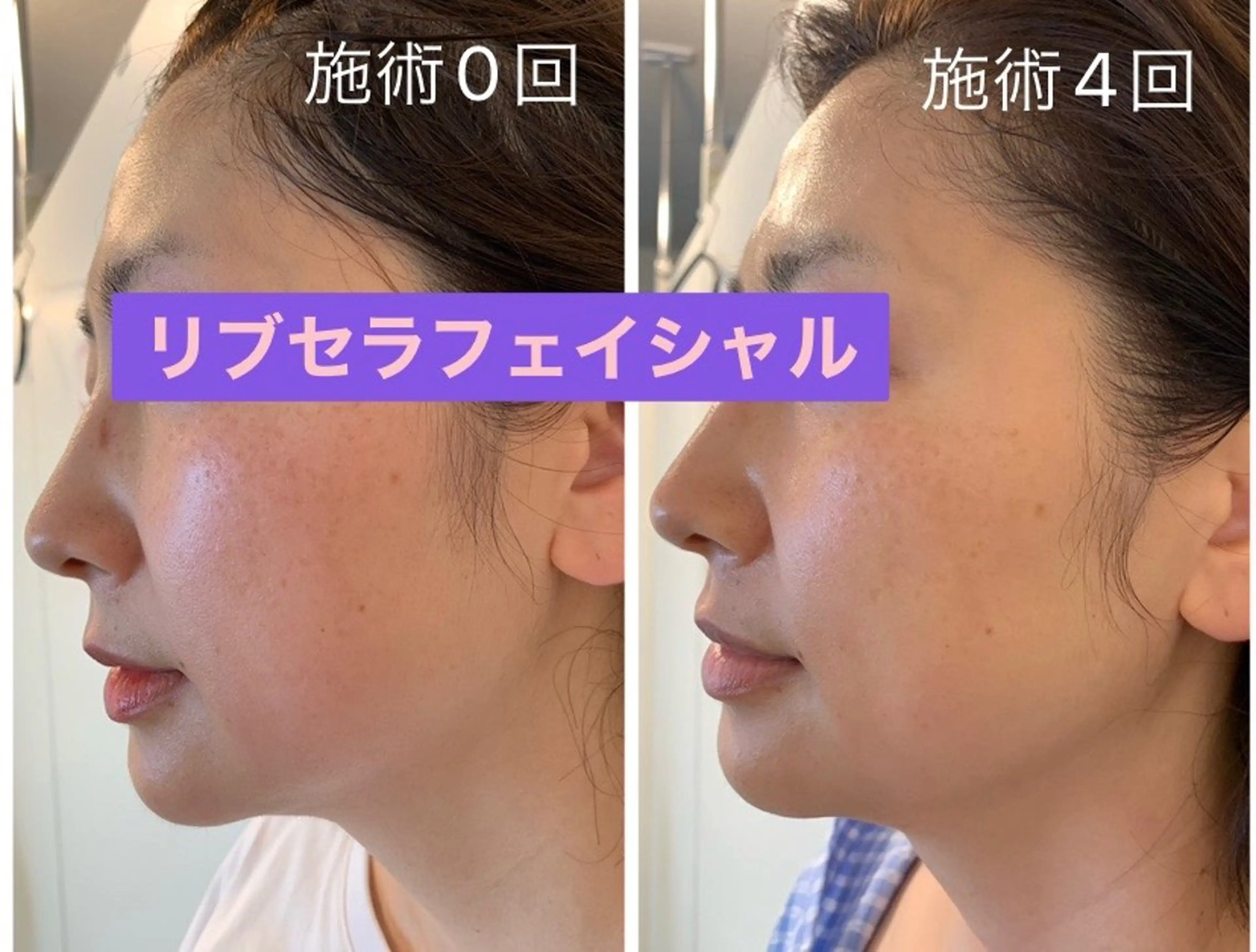 エステ Private Salon Prunelle所属・プライベートサロン プリュネルのエステ・リラクイメージ