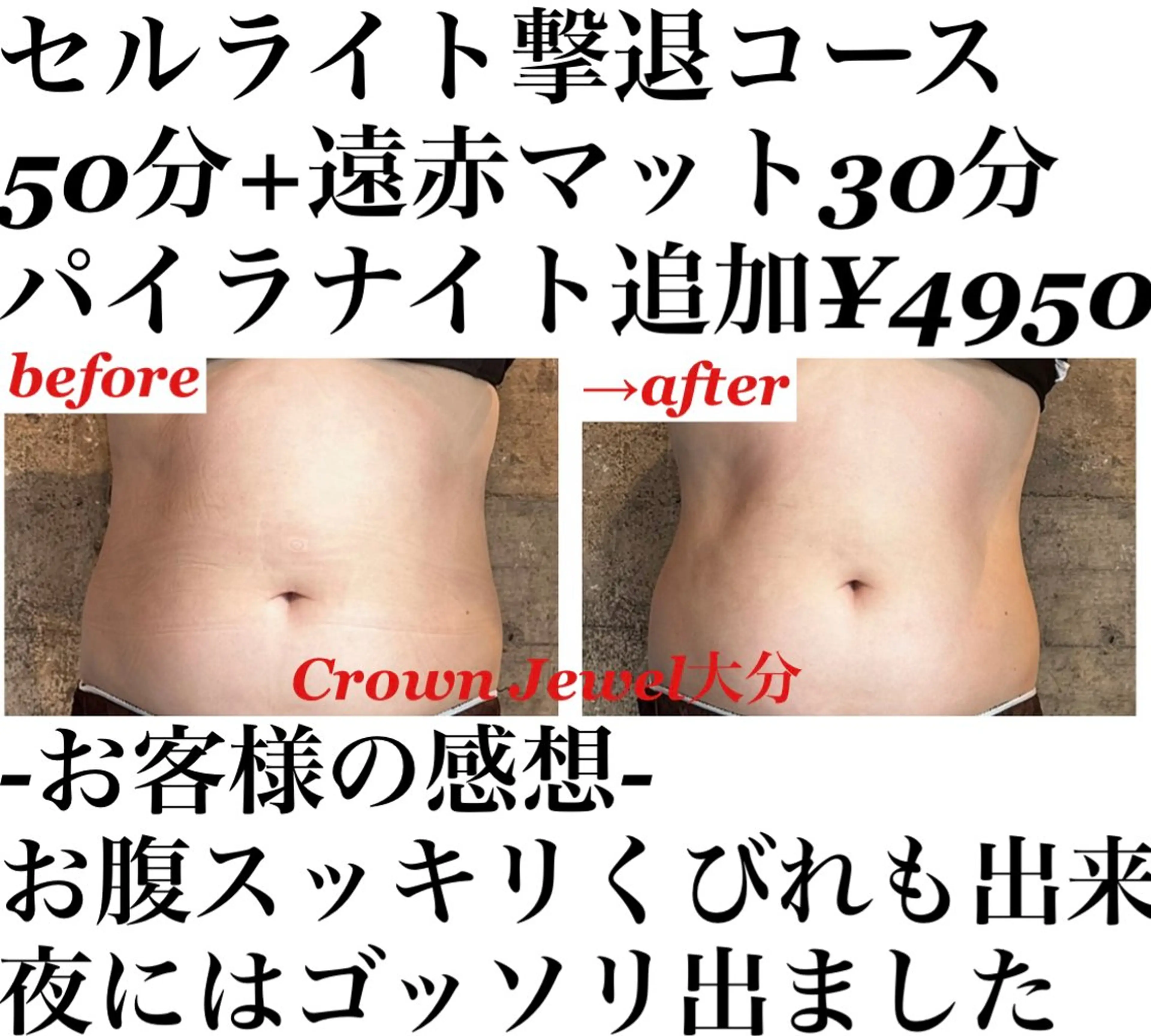 Crown  Jewel所属・CrownJewel クラウン ジュエルのエステ・リラクイメージ