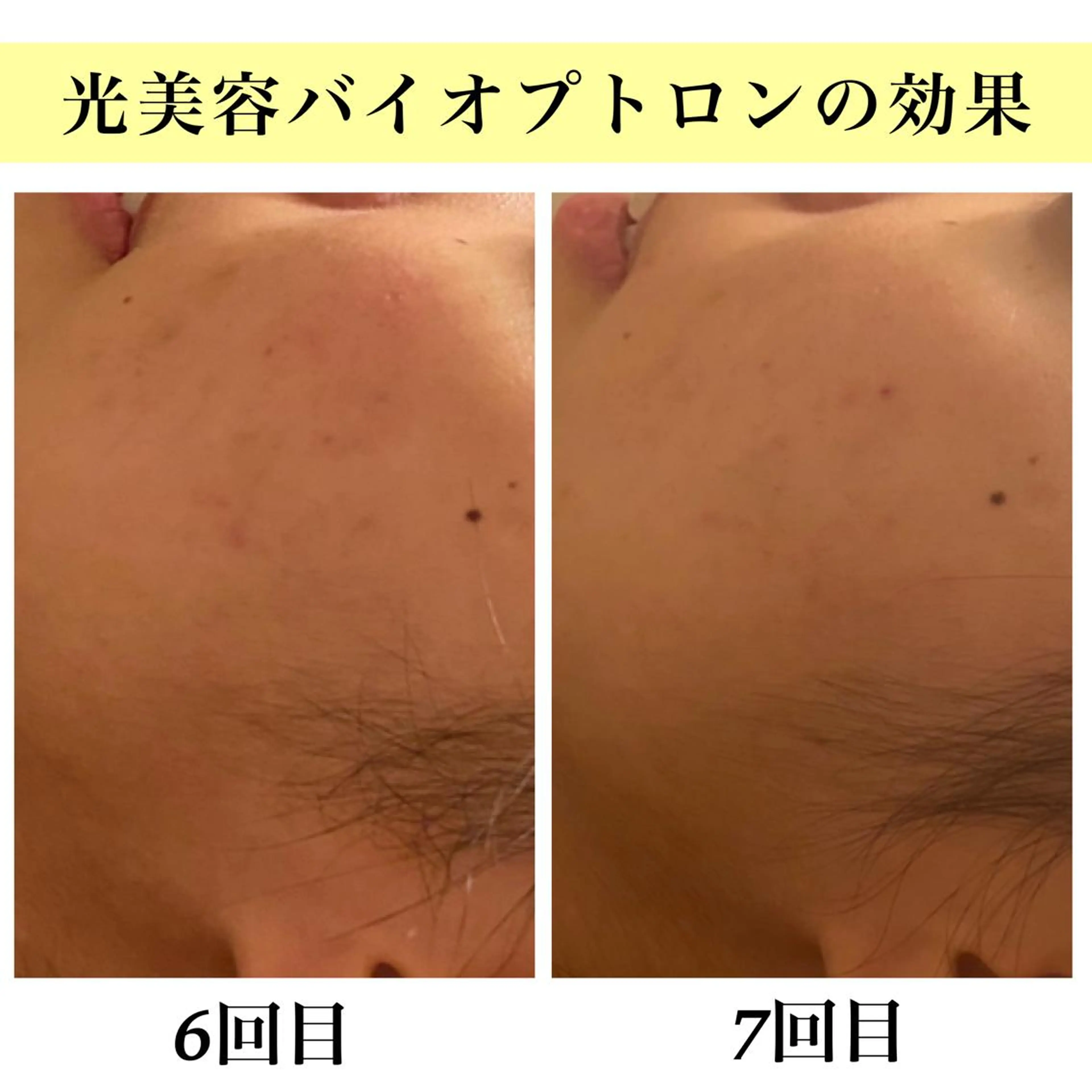 Bellesthe (ベルエステ)のエステ・リラクイメージ