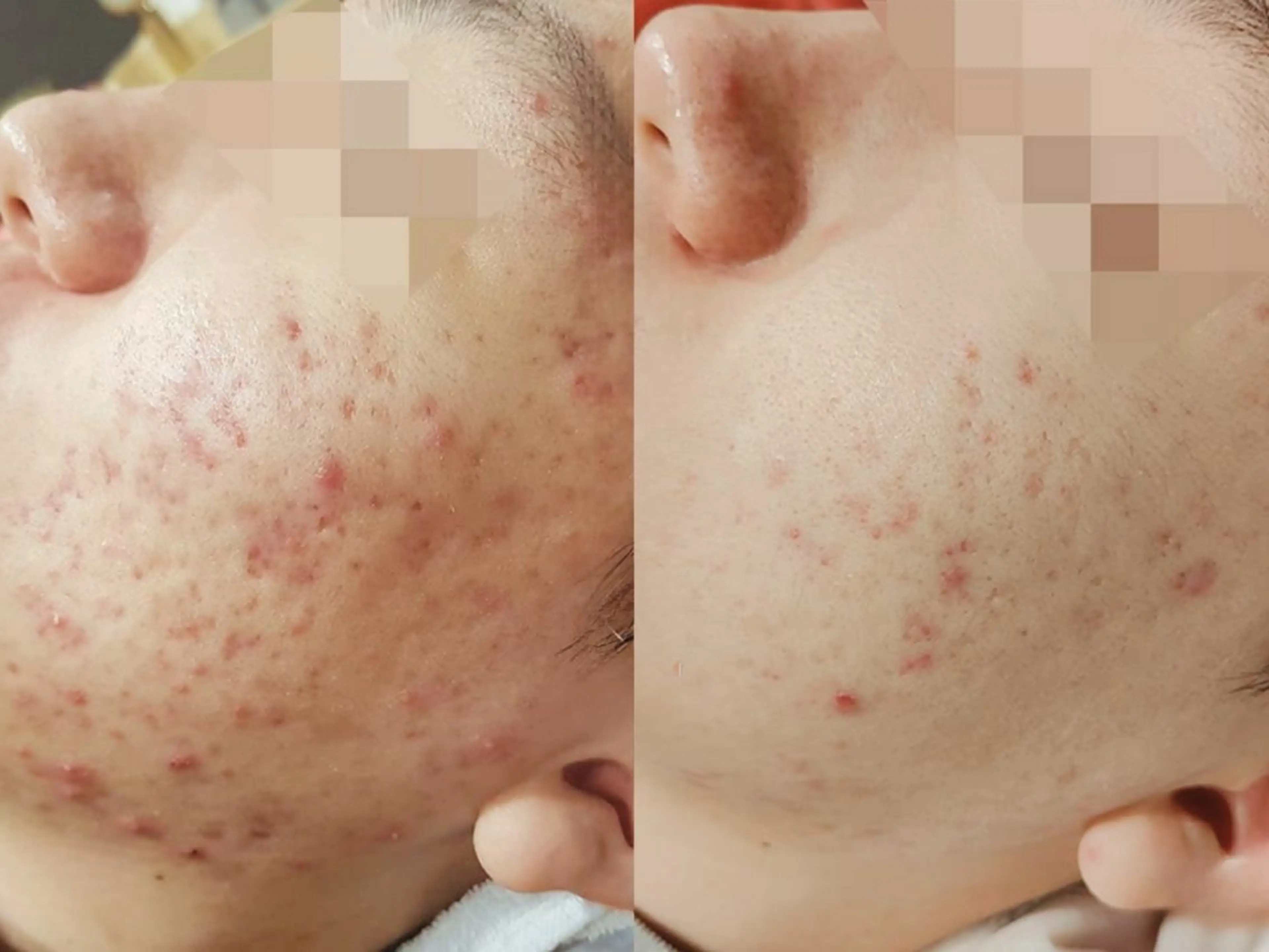 エステ UILANI所属・UI LANIのエステ・リラクイメージ