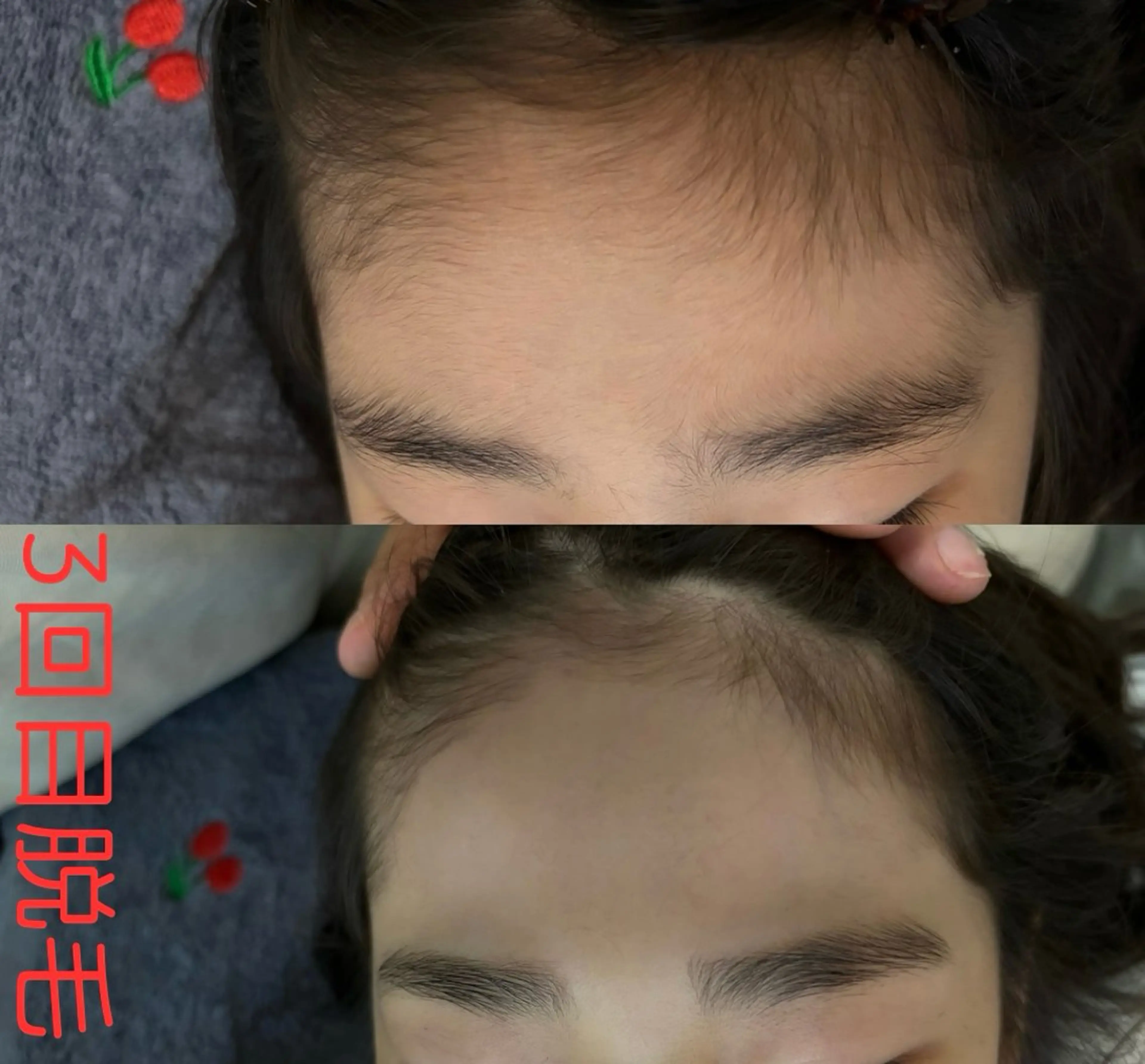 キッズ プライベート脱毛 Jr久宝寺のエステ・リラクイメージ