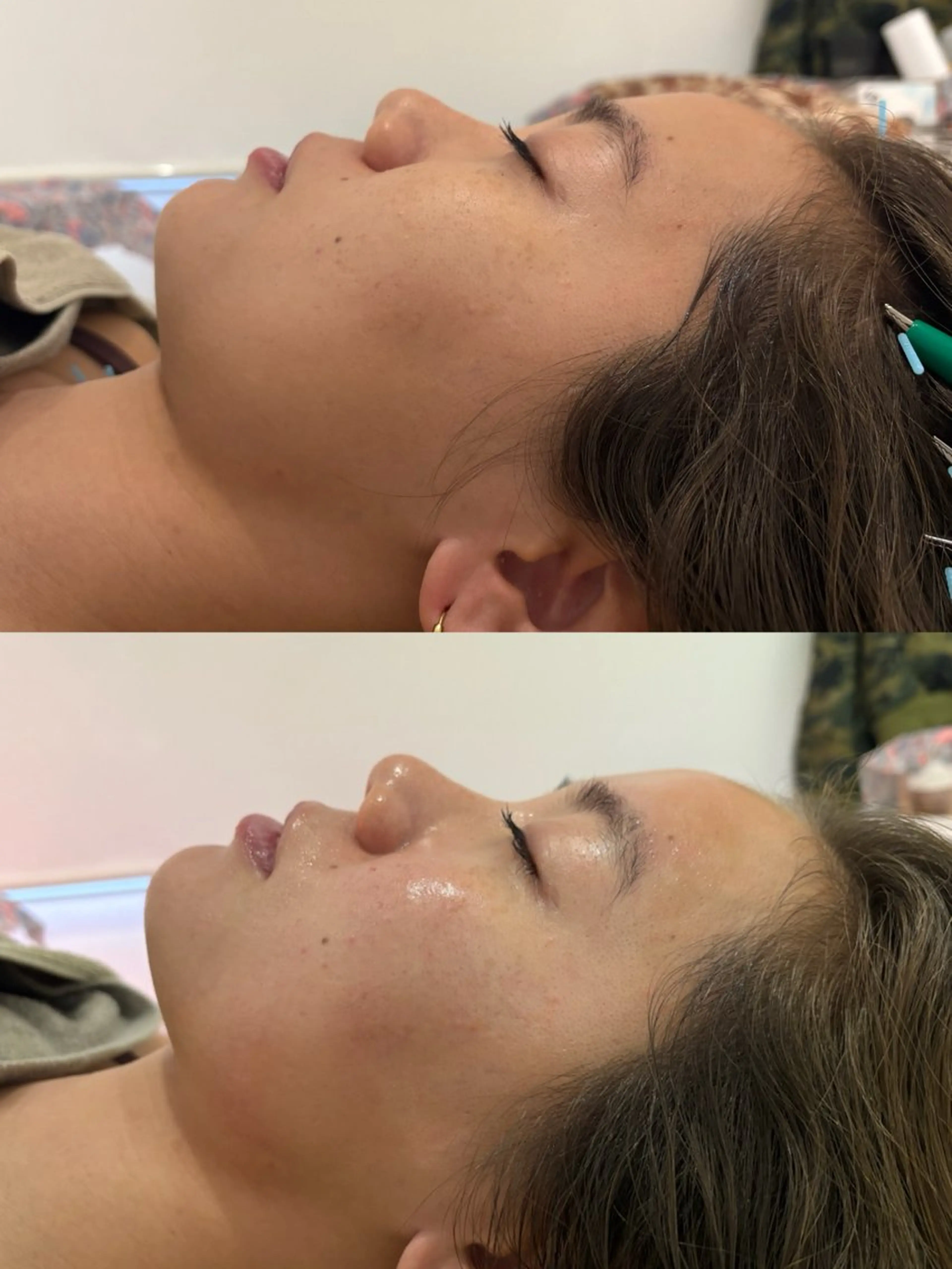 エステ リラク 美容鍼灸サロン mahoroba院長のエステ・リラクイメージ