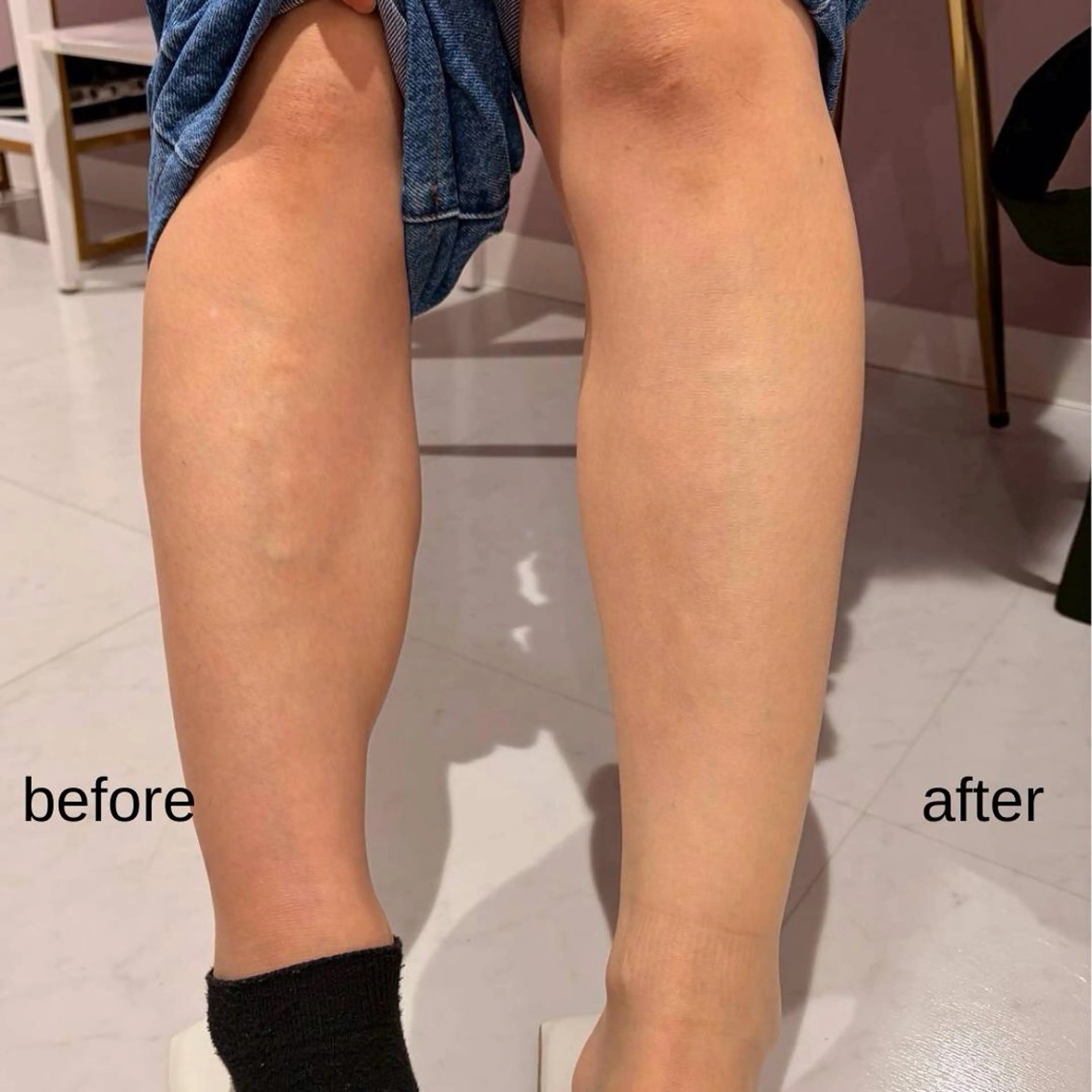 アイアンド ネイルデイのエステ・リラクイメージ