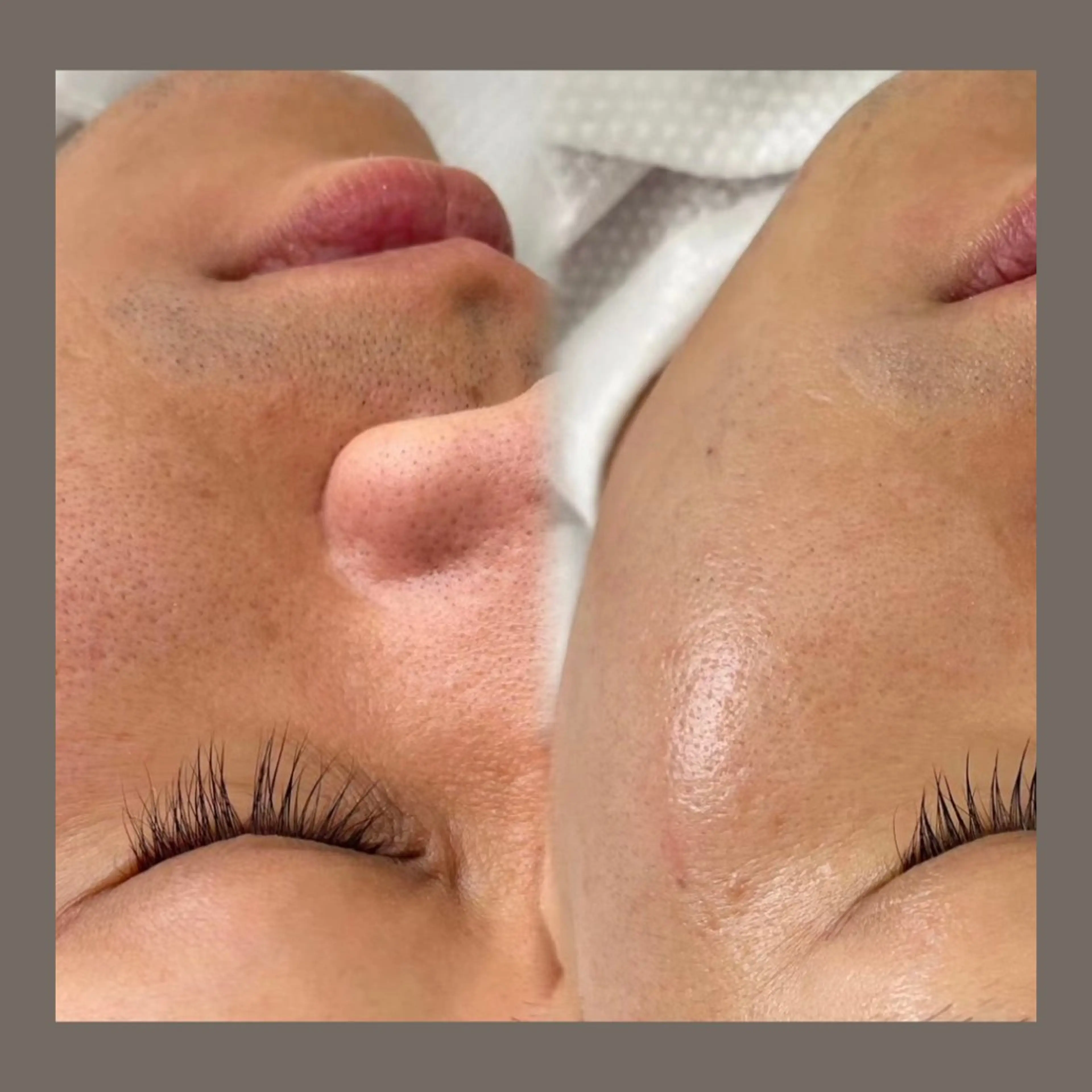 エステ リラク 愛維美水光美肌専門店所属・愛維美水光美肌専門店 メンズレディースokのエステ・リラクイメージ