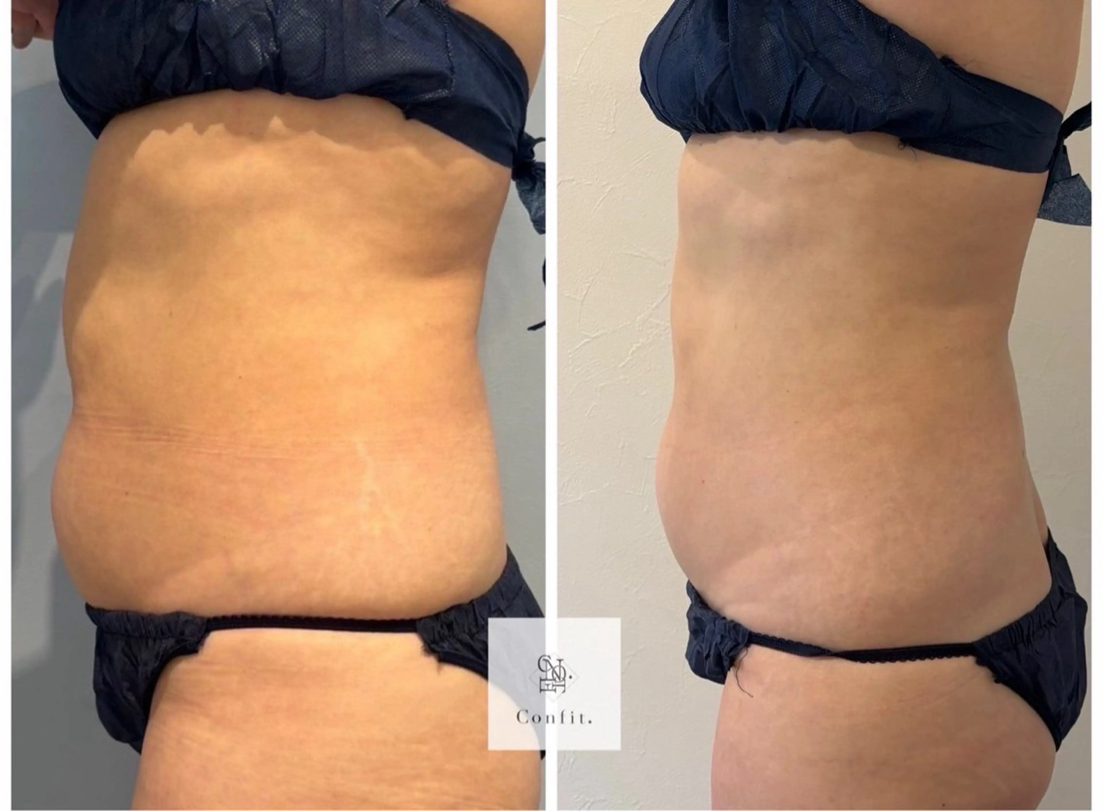 エステ 小顔/たるみ/黒ずみ除去専門サロン/SONA 大和西大寺店所属・【小顔痩身専門看護師 サロンSONA】のエステ・リラクイメージ