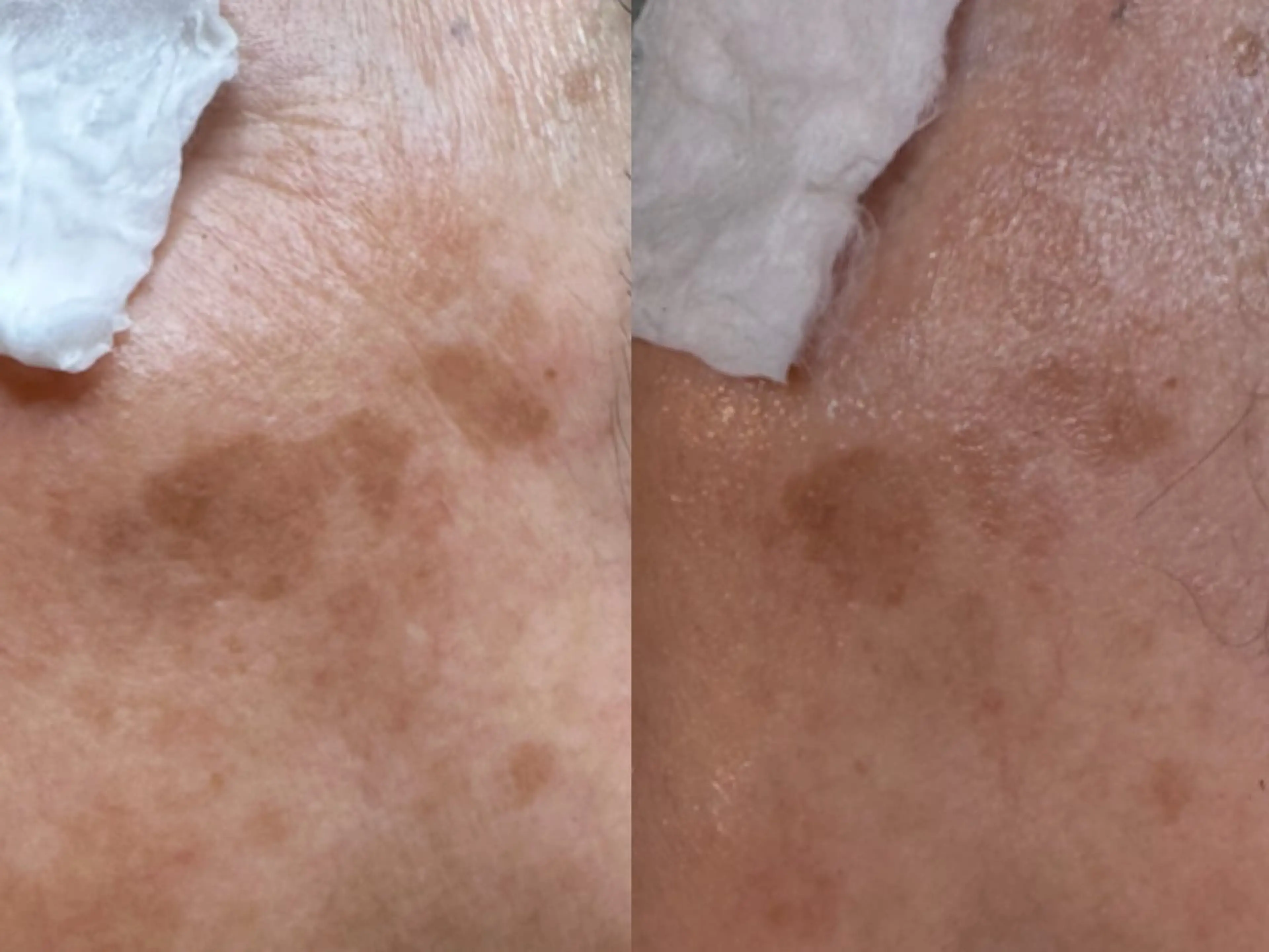 その他 大久保 里奈のエステ・リラクイメージ