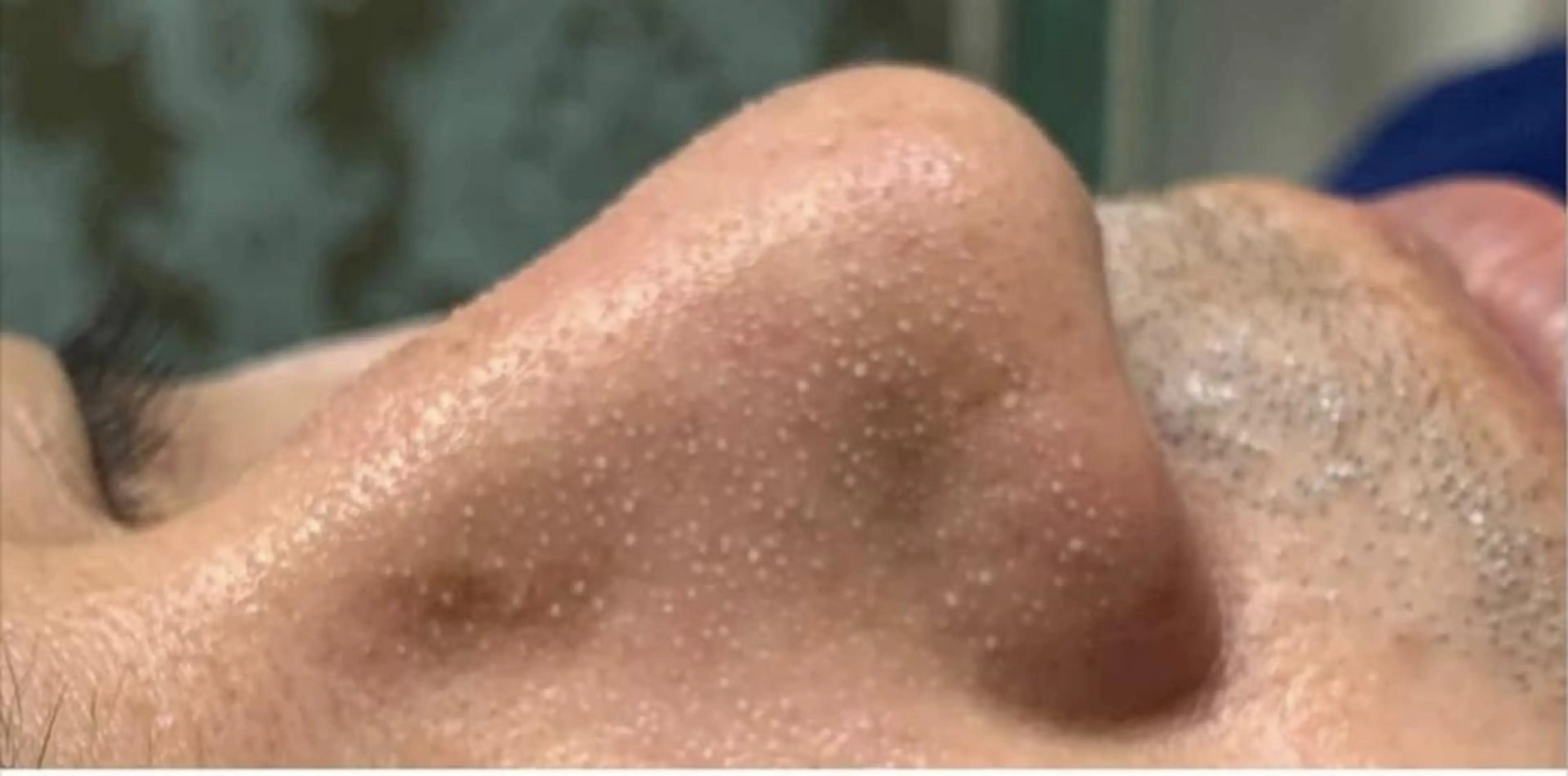 毛穴フェイシャル エステ専門店BBのエステ・リラクイメージ