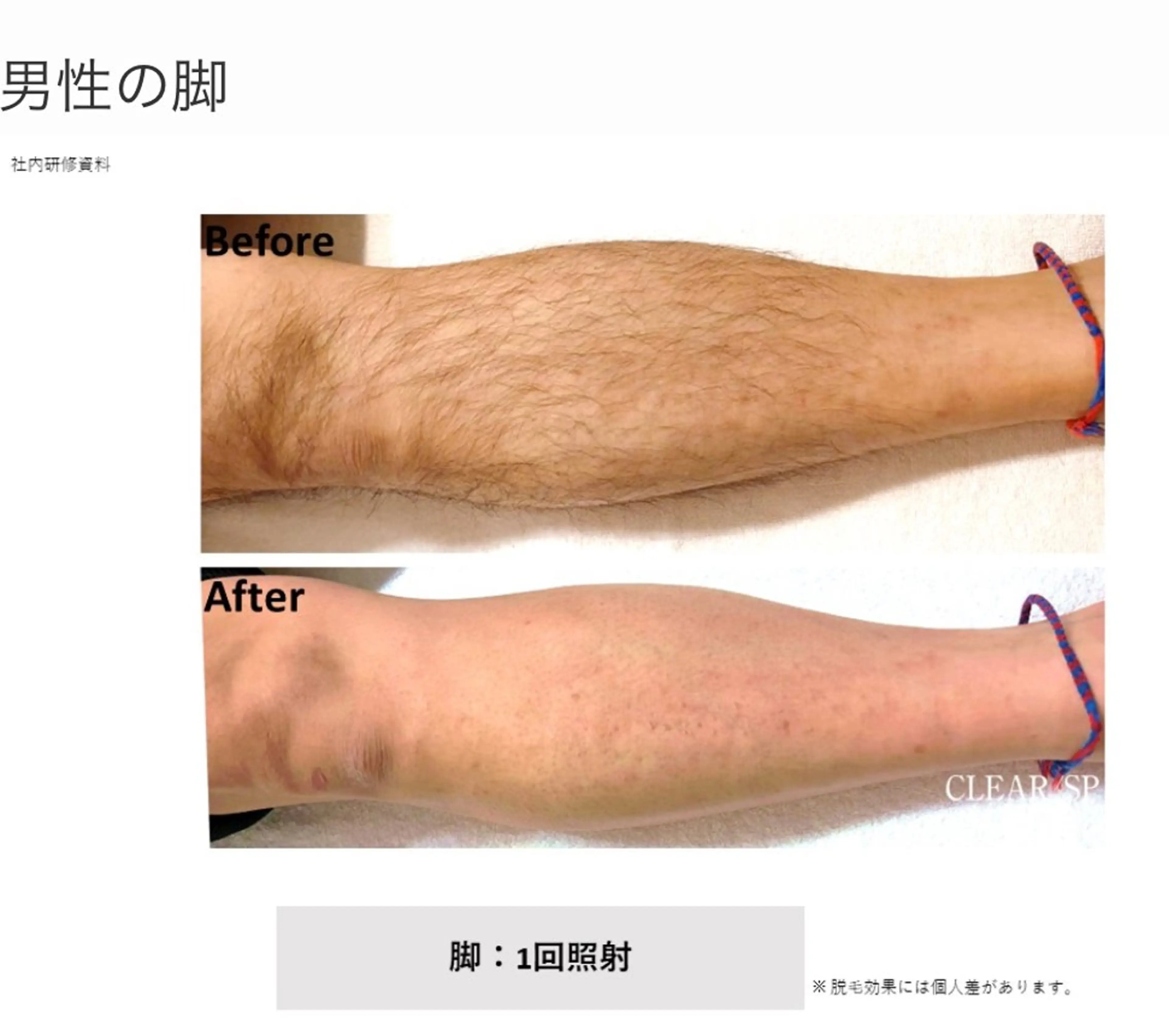 【痩身・脱毛】private salon Eclat所属・伊藤 心のエステ・リラクイメージ