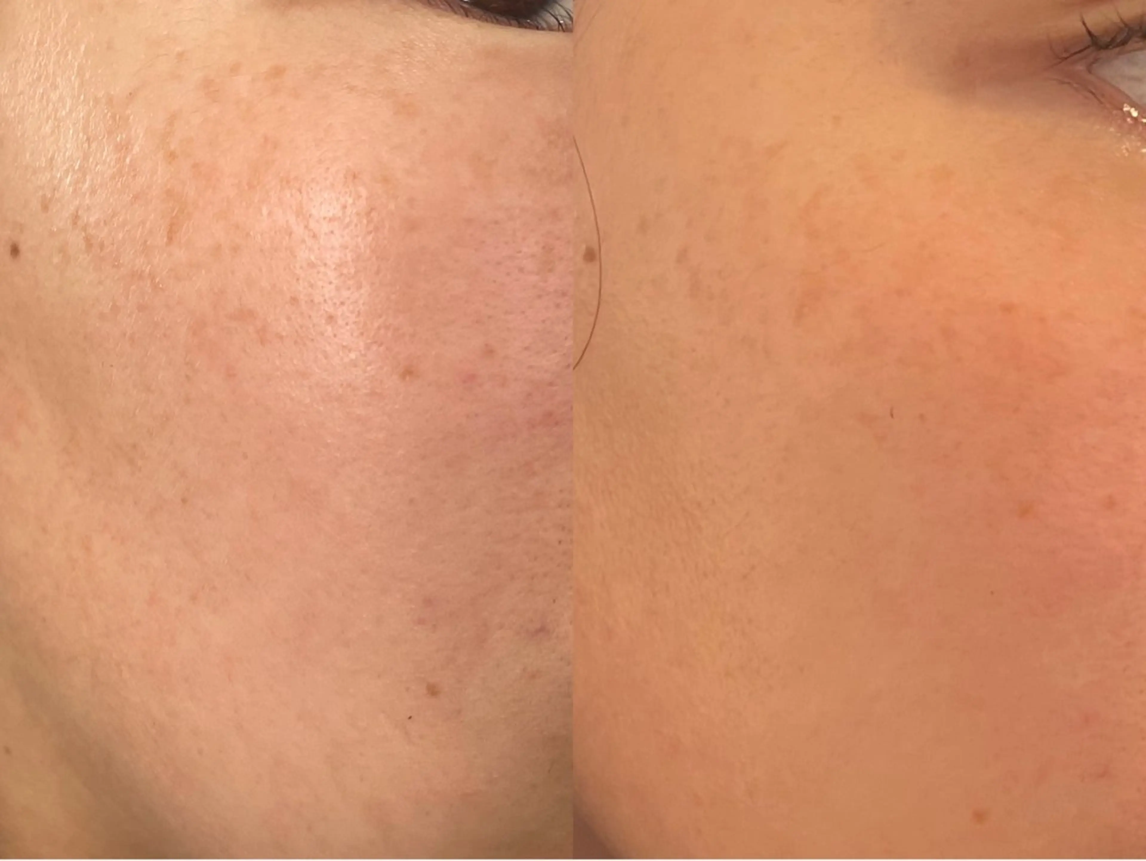 エステ La・Bellvie所属・La･Bellvie 【星ヶ丘店]のエステ・リラクイメージ