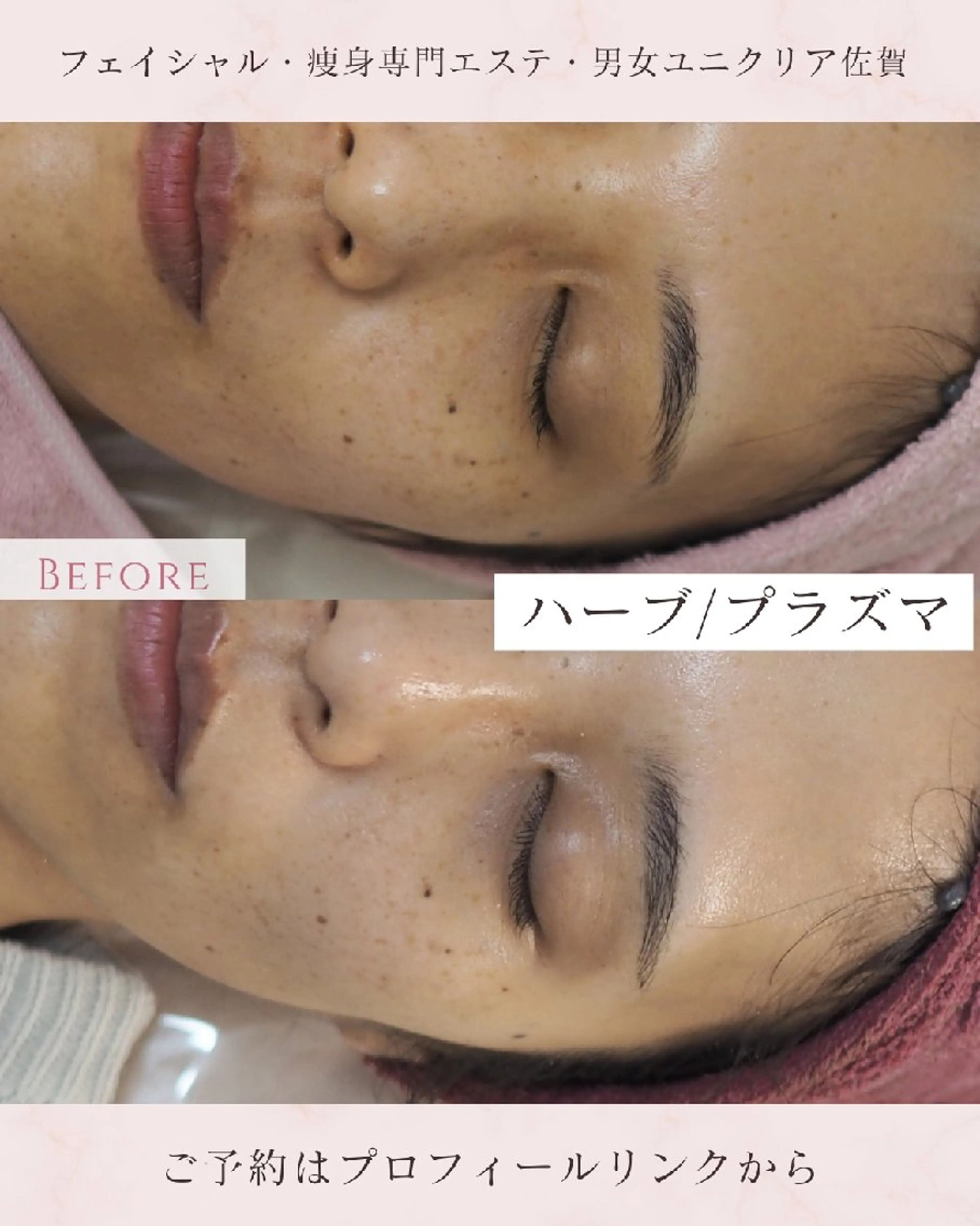 エステ ユニセックスエステサロンUniclear所属・痩身&フェイシャル Uniclearのエステ・リラクイメージ