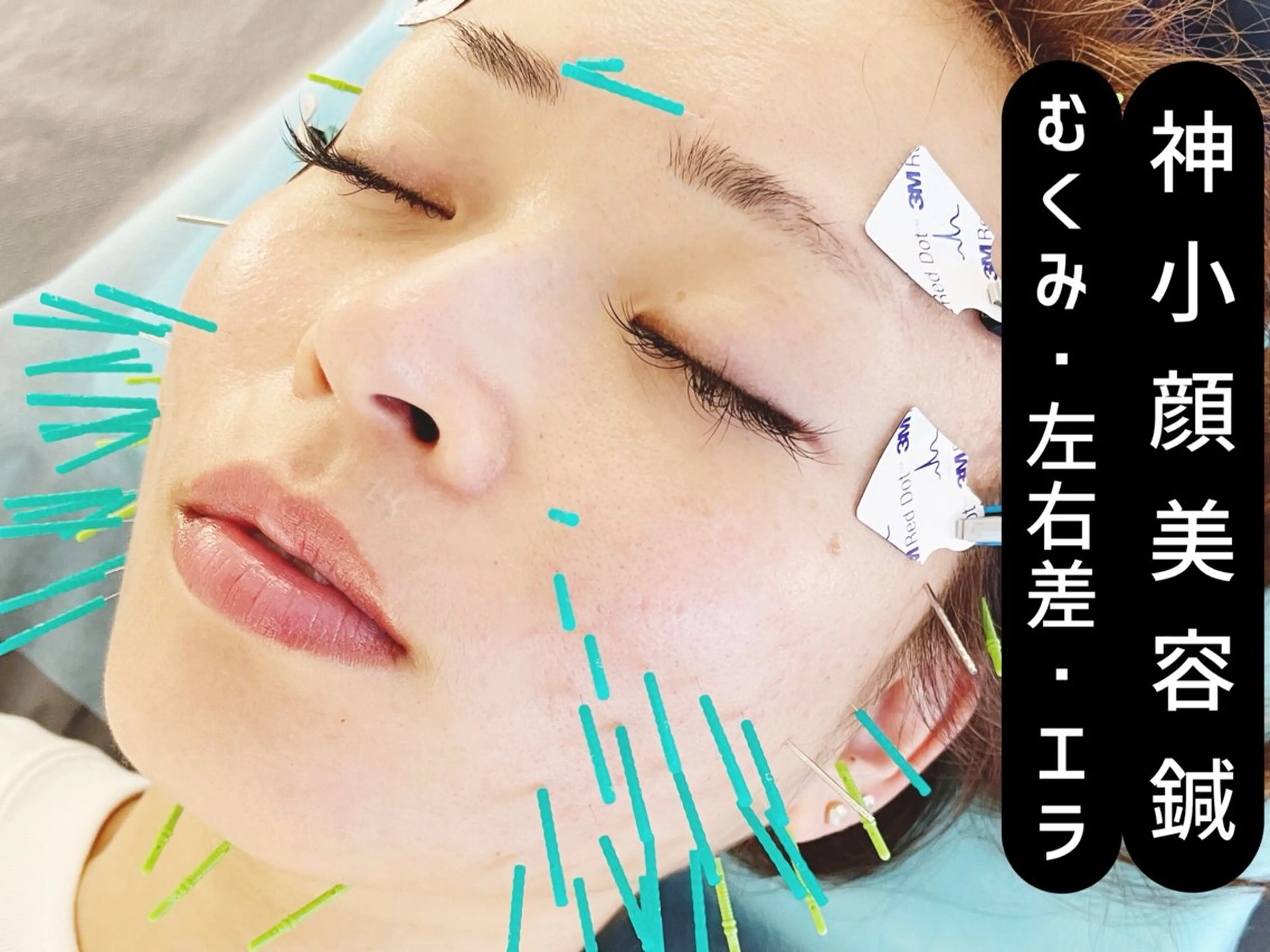 エステ リラク 小顔美容鍼専門サロン 渋谷YZのエステ・リラクイメージ