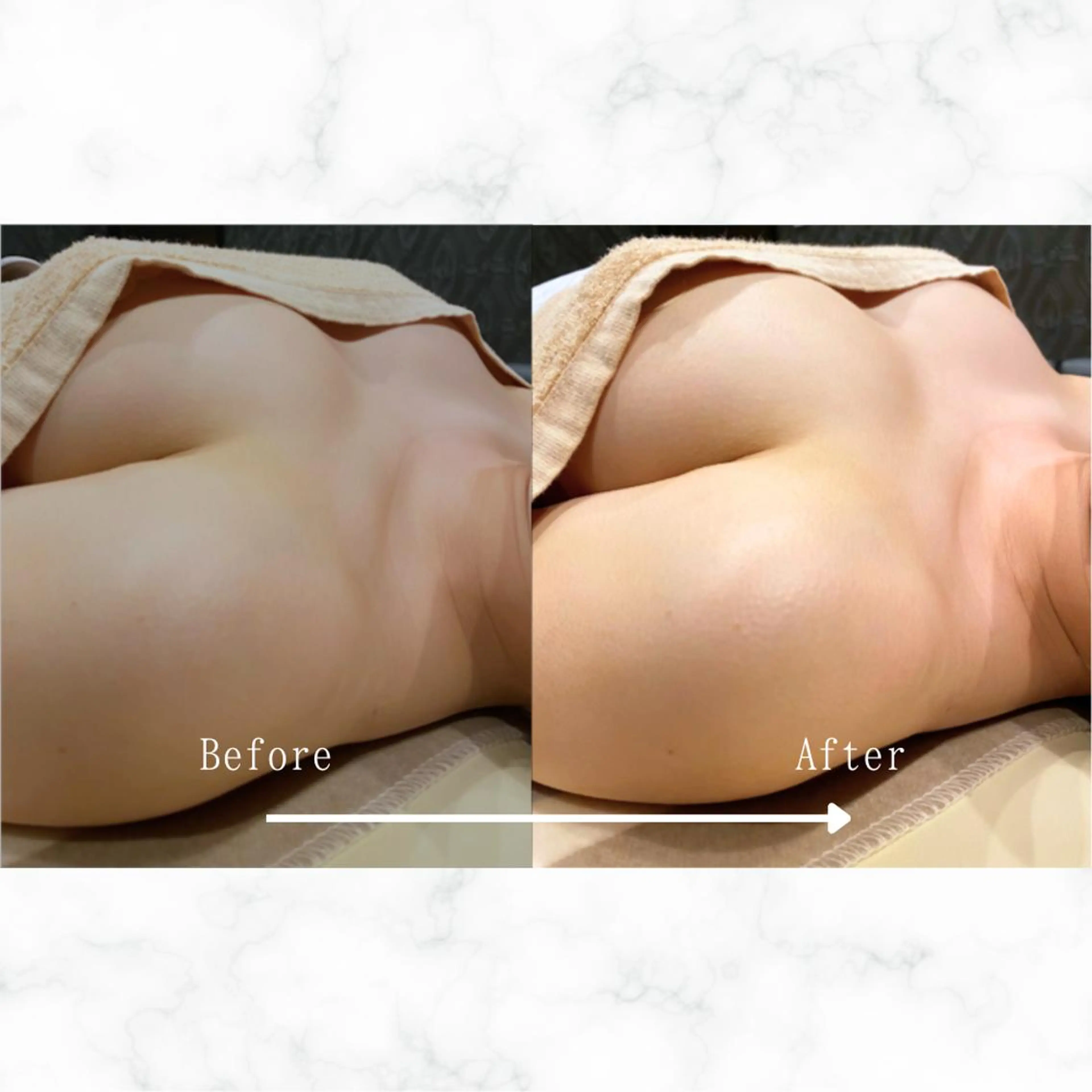 【人気No.1】迷ったらコレ!ふっくらバストアップ実感 ¥22,000→¥5,800の写真
