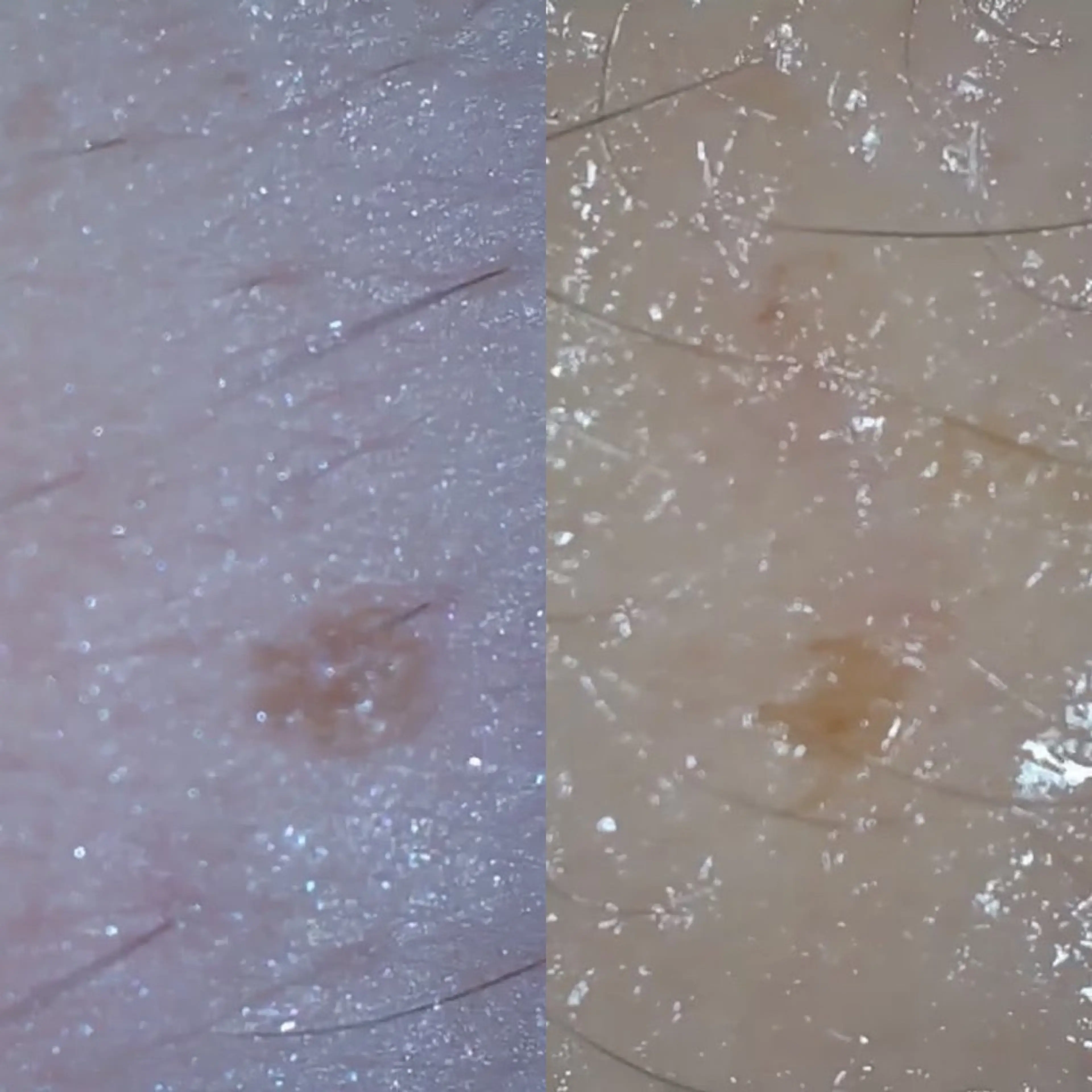 エステ リラク デアイム東広島所属・中井 小春のエステ・リラクイメージ