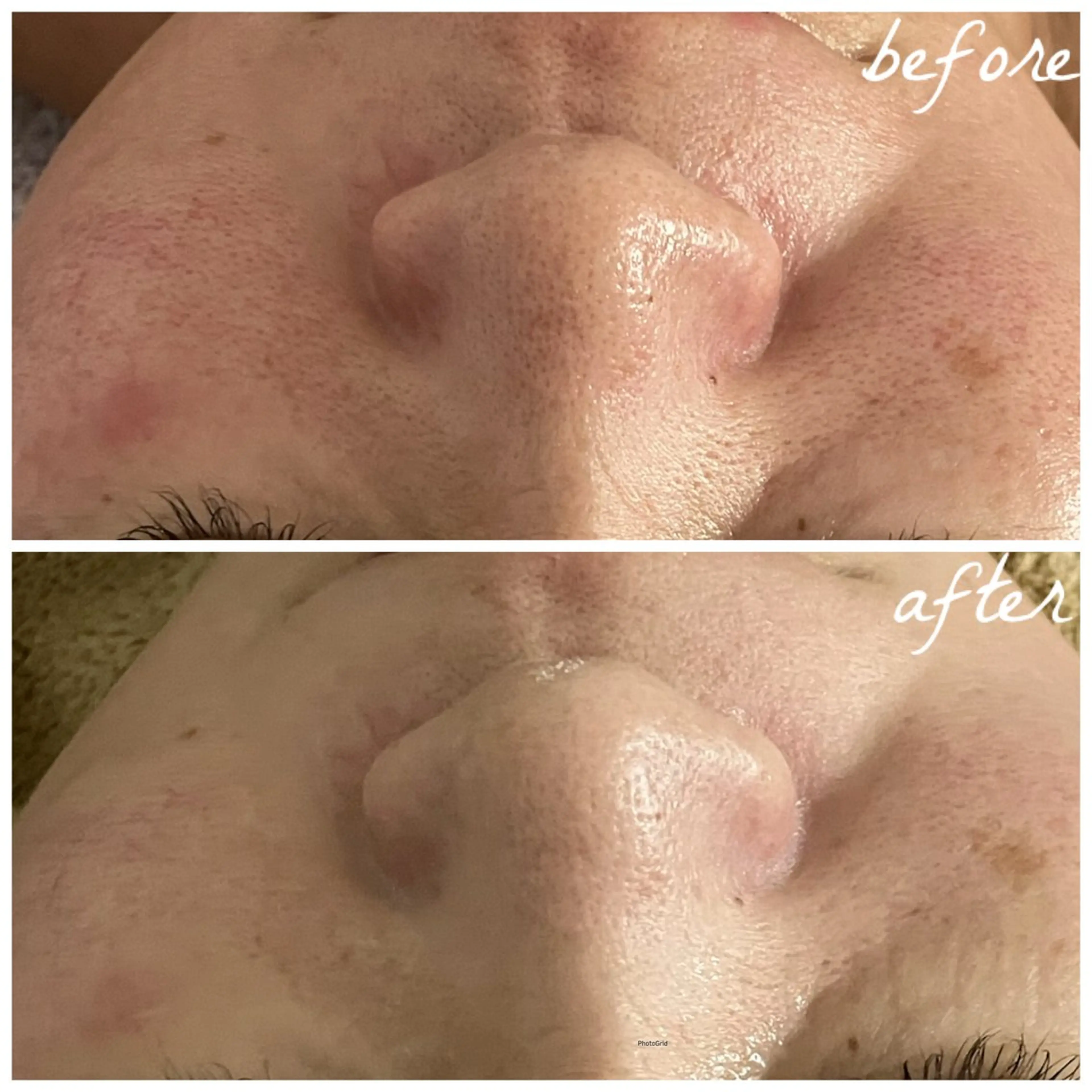 メンズ エステ メナード岐阜茜部 杉浦のエステ・リラクイメージ