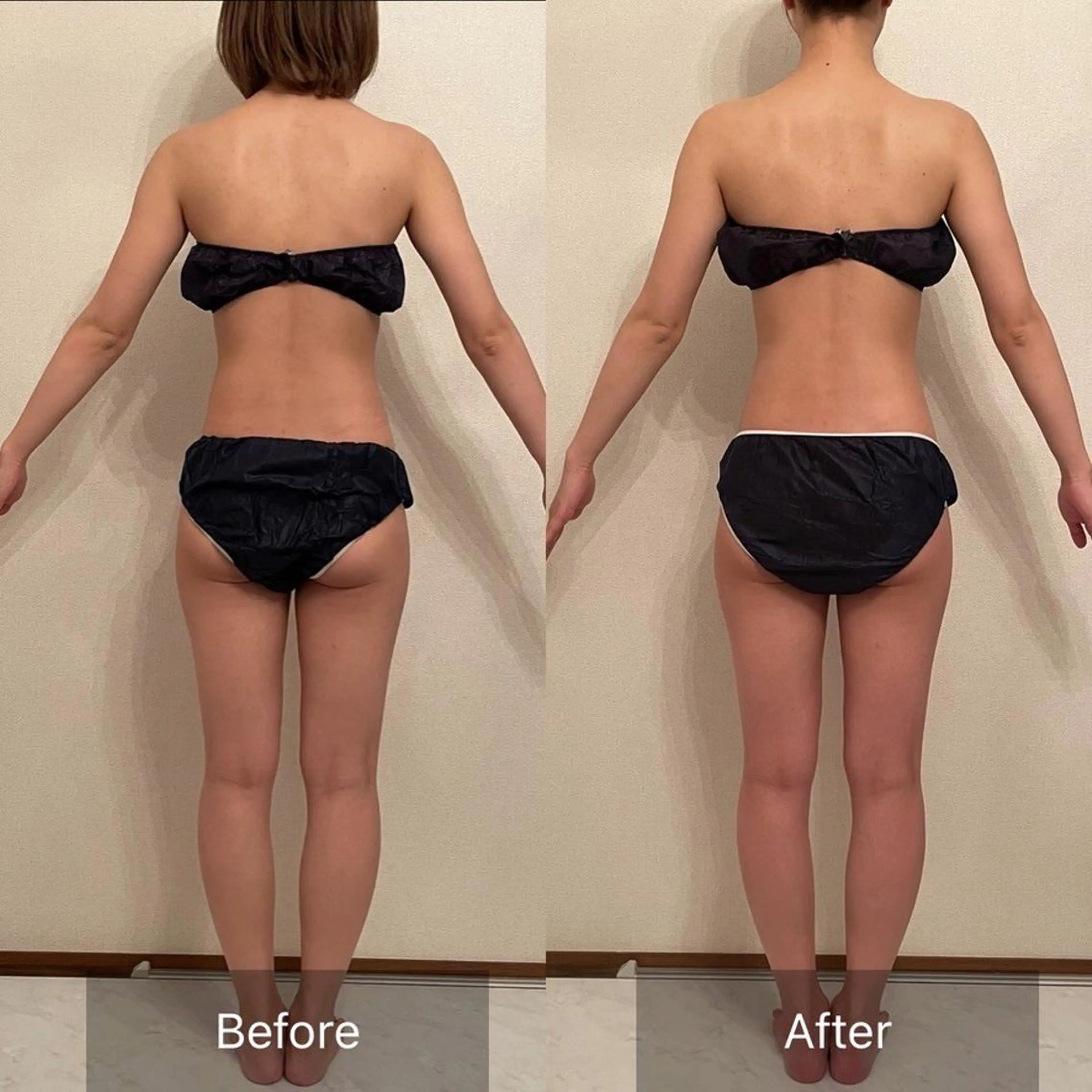 《寝てるだけでサイズダウン❗️インディバ超え❗️全身マッサージWINBACK 75分❗️》✨💎✨の写真