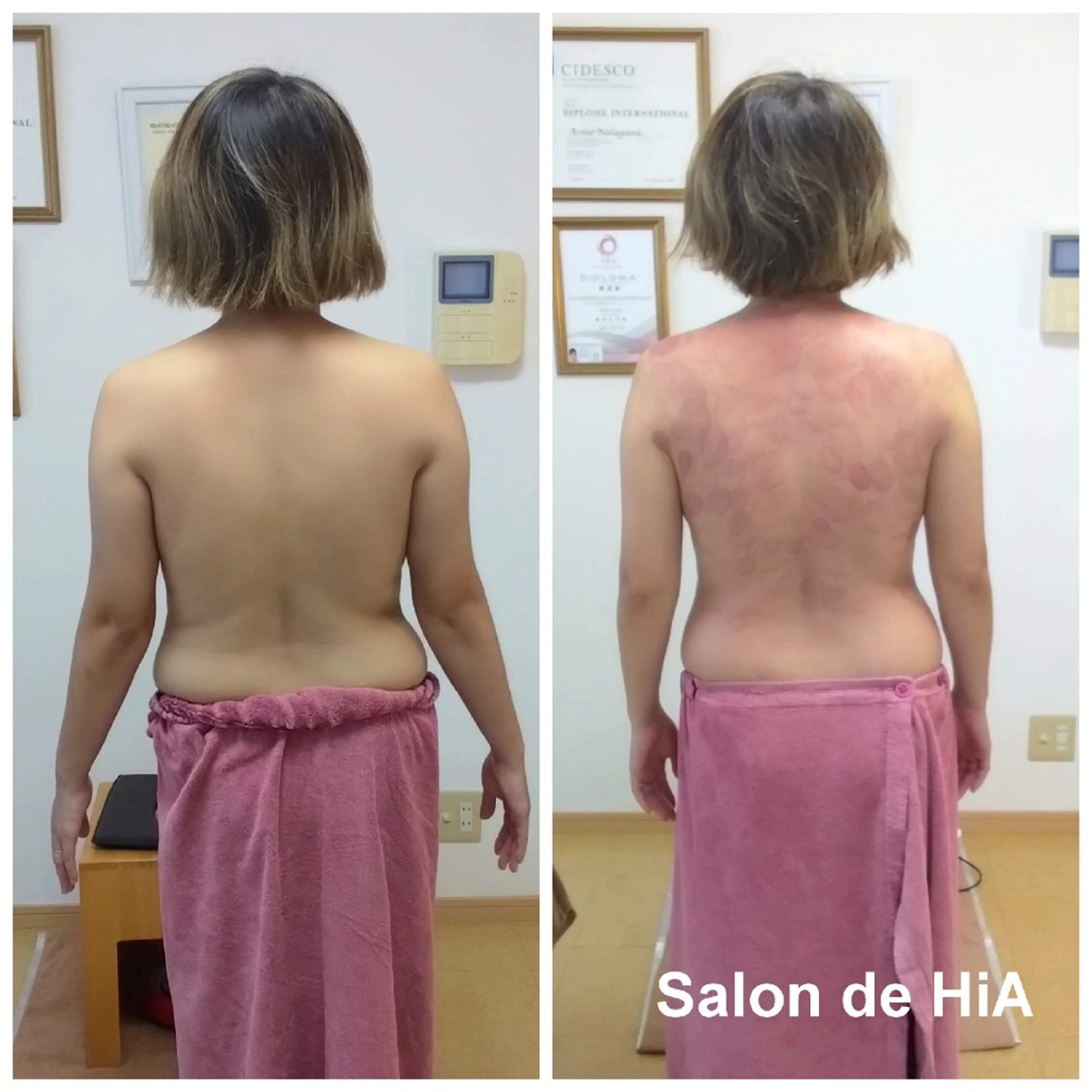 エステ リラク Salon de  HiAのエステ・リラクイメージ