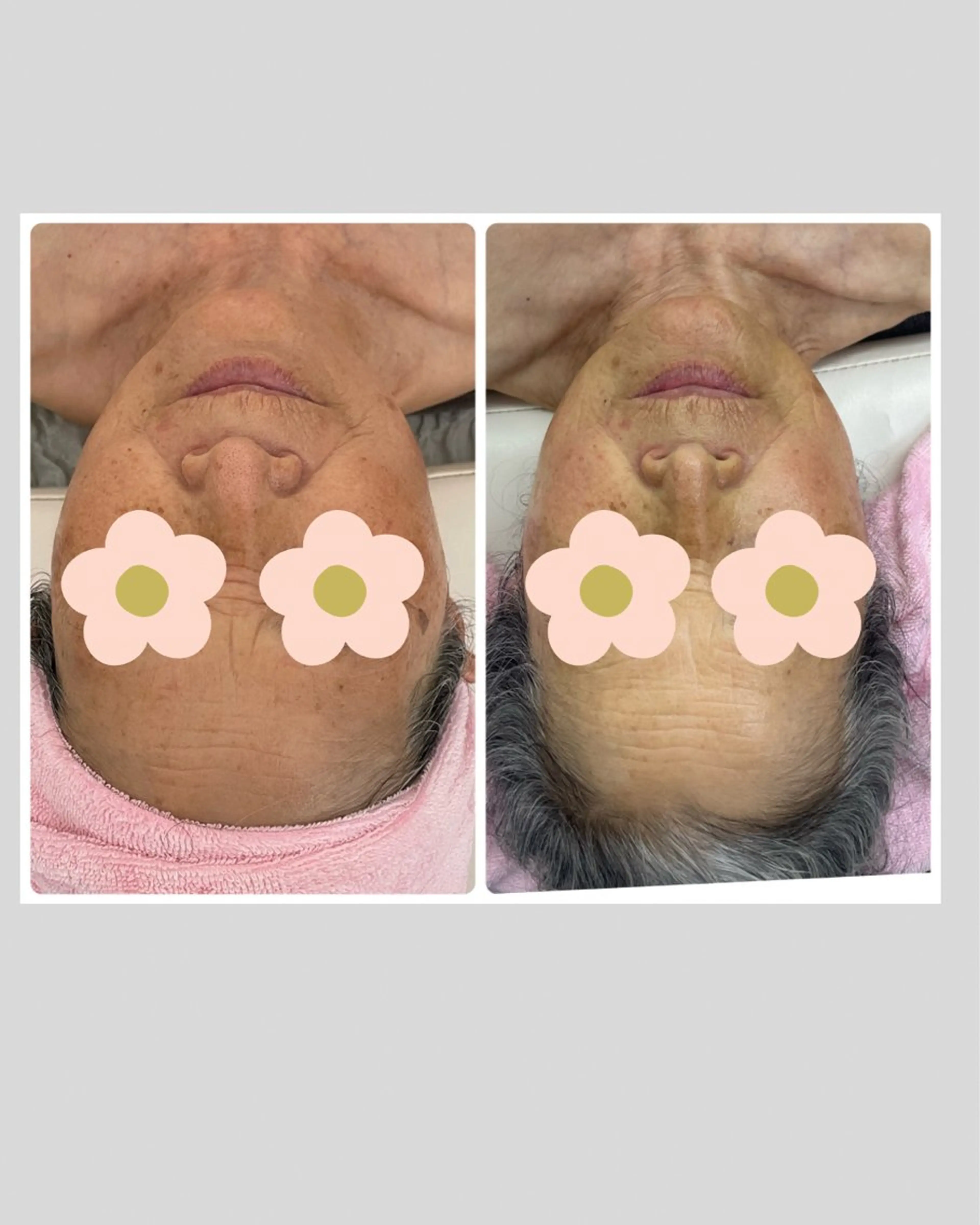 Salon Rion所属・Rion 野々村のエステ・リラクイメージ