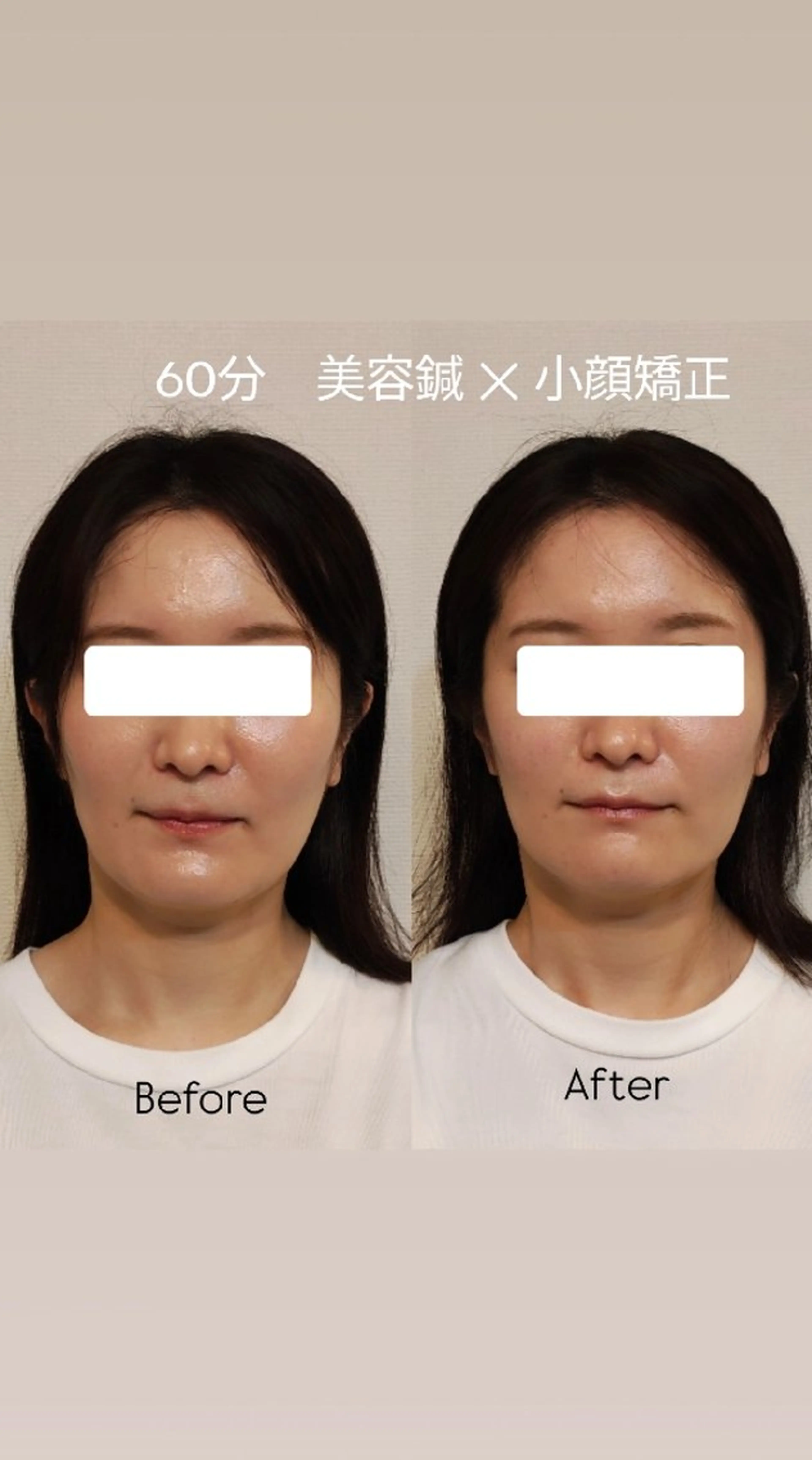 美容鍼灸サロンAria所属・美容鍼サロンAria 杉元みつるのエステ・リラクイメージ