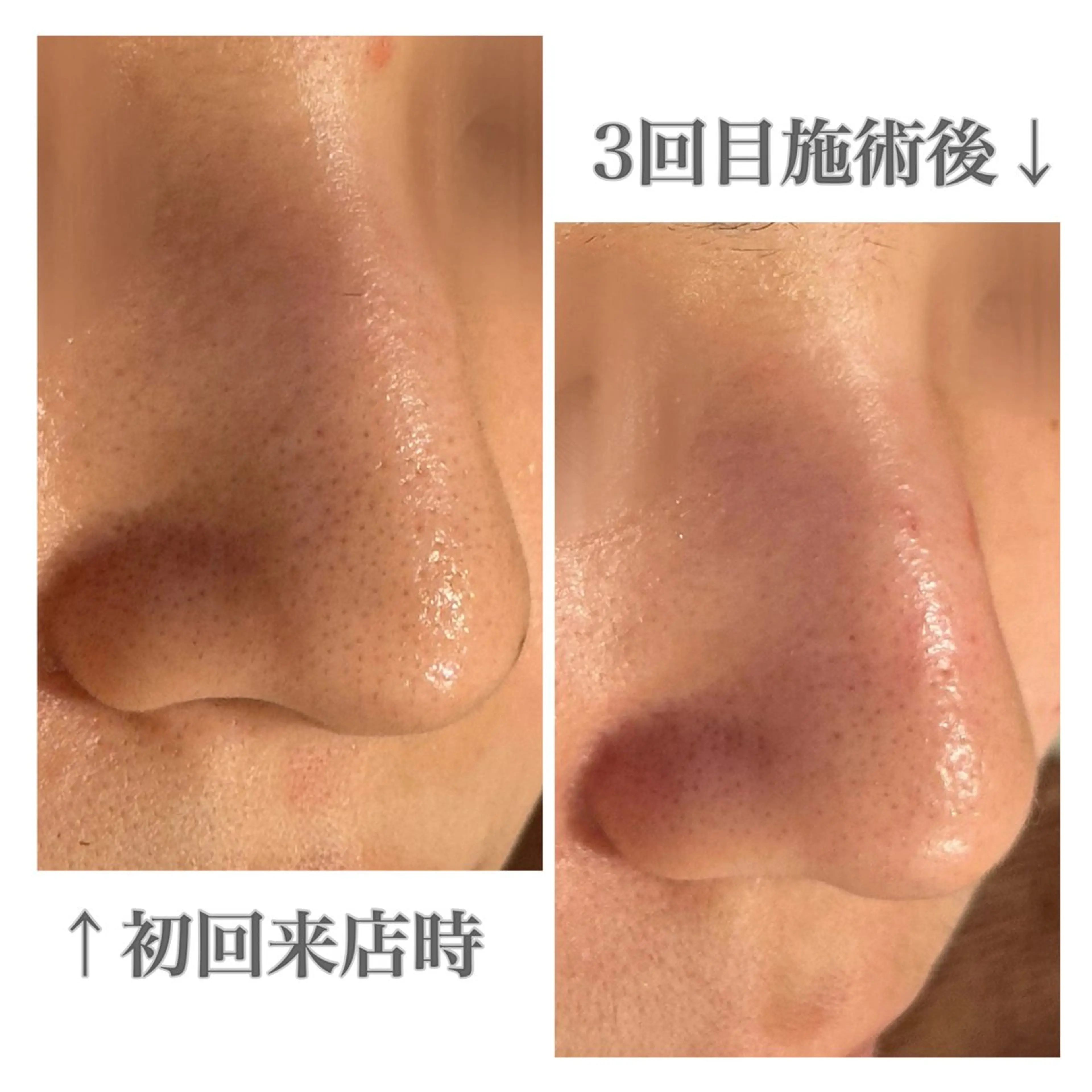 メンズ眉毛サロンラボ所属・メンズ眉毛サロンラボ 🫧 牧田 雪乃の眉毛・アイブロウイメージ