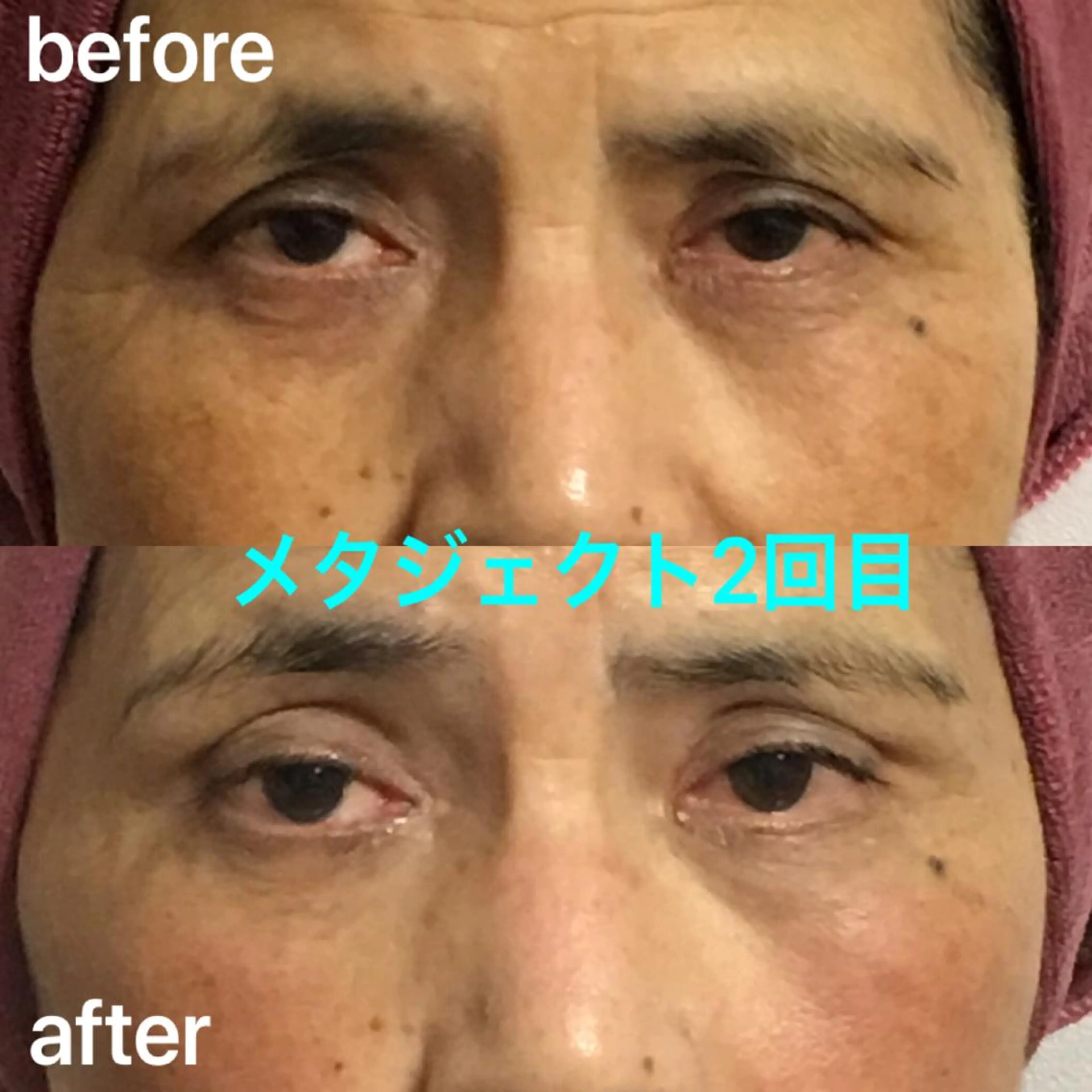 エステ 氣楽所属・松下 さゆりのエステ・リラクイメージ