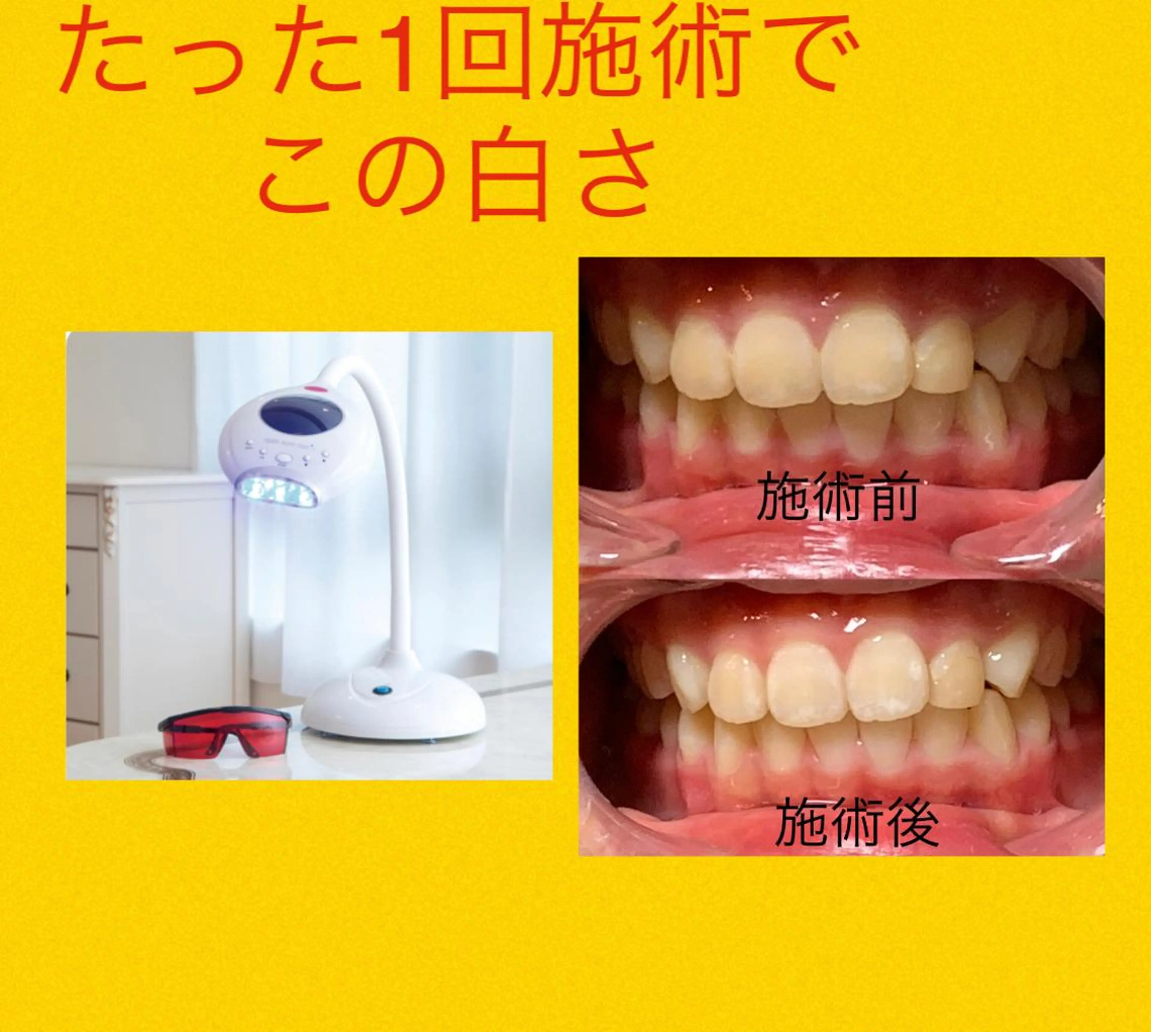 整体フェイシャル EMINALのエステ・リラクイメージ