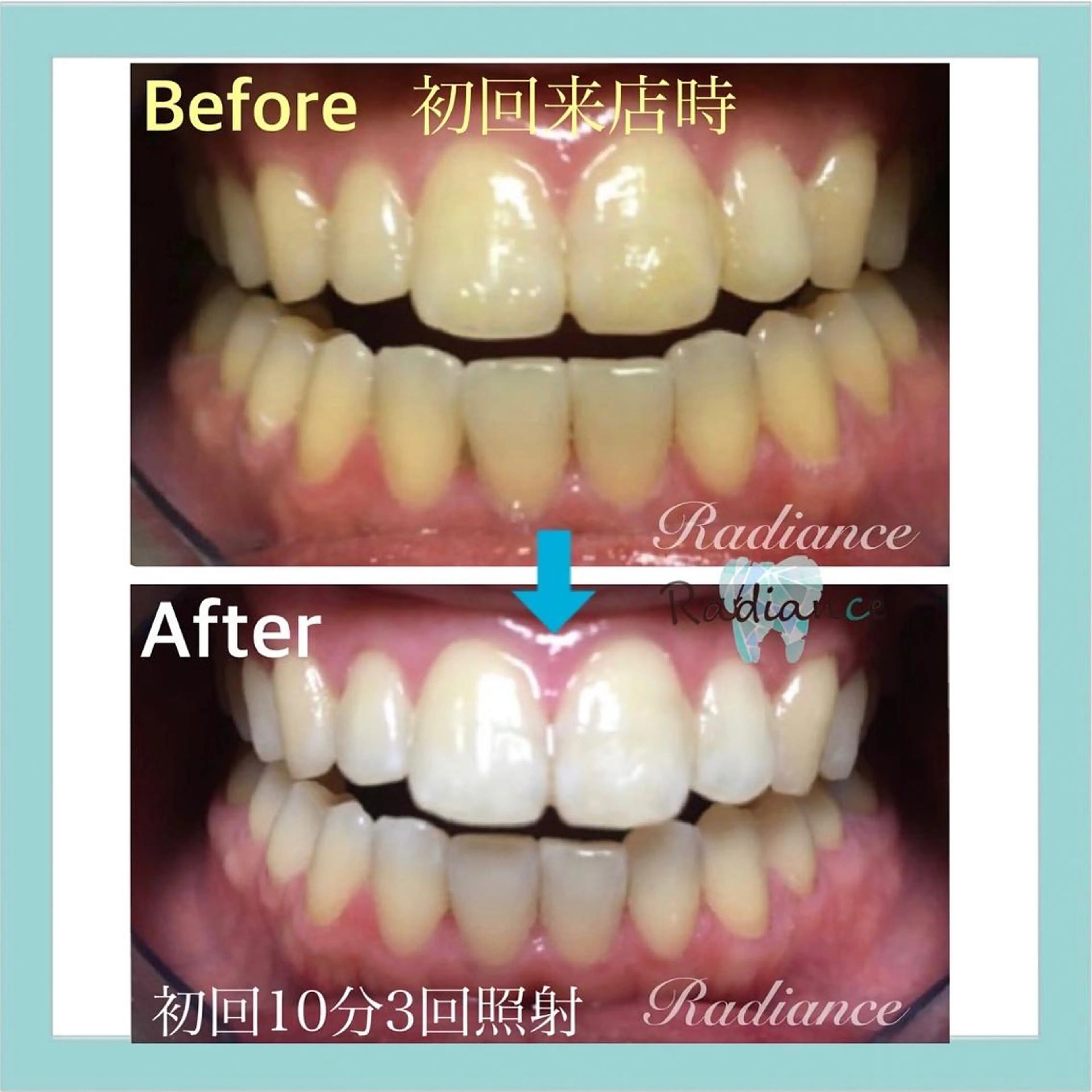 その他 札幌ホワイトニング ラディアンス札幌駅店のその他イメージ