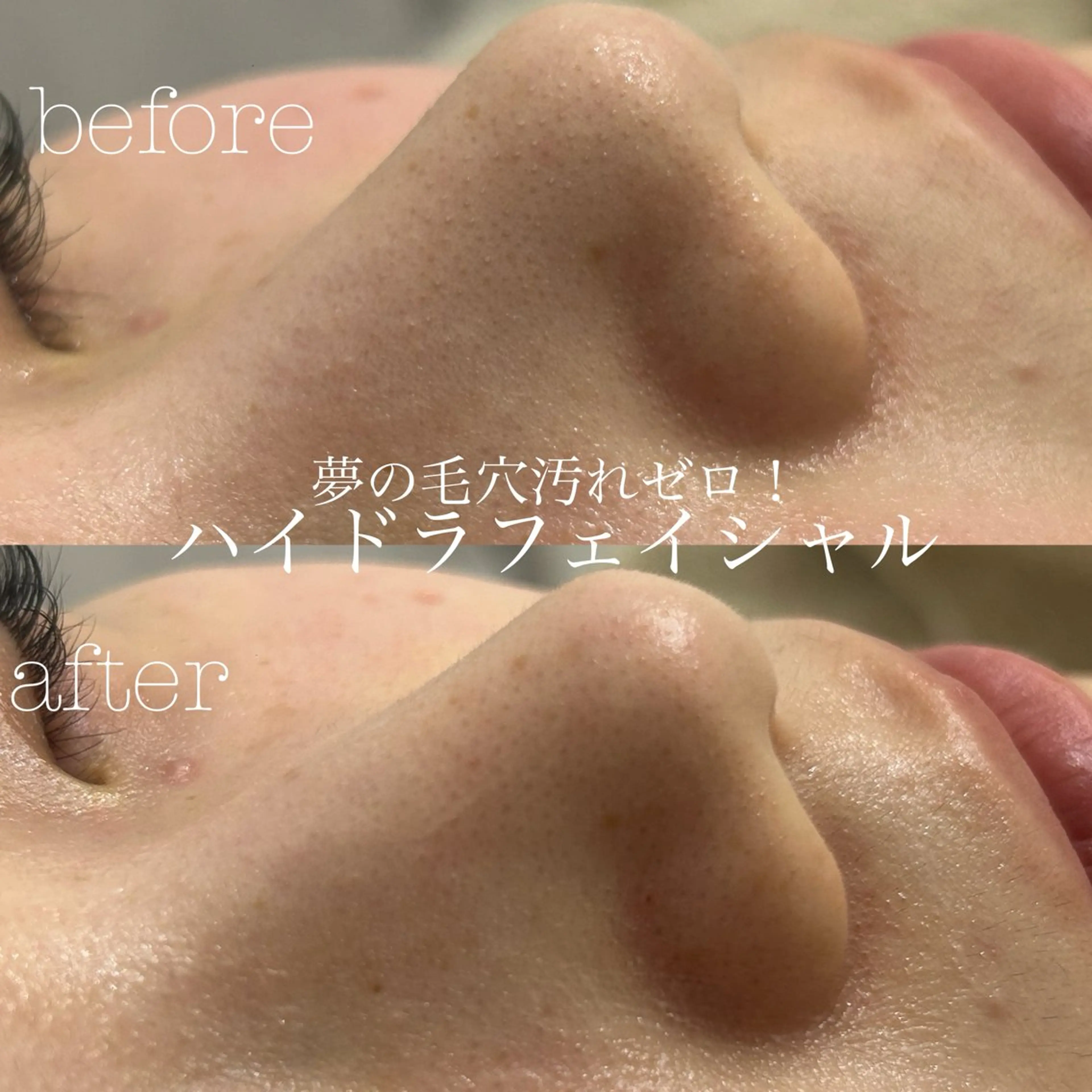 エステ フェイシャルサロン CHIARA 荒田のエステ・リラクイメージ