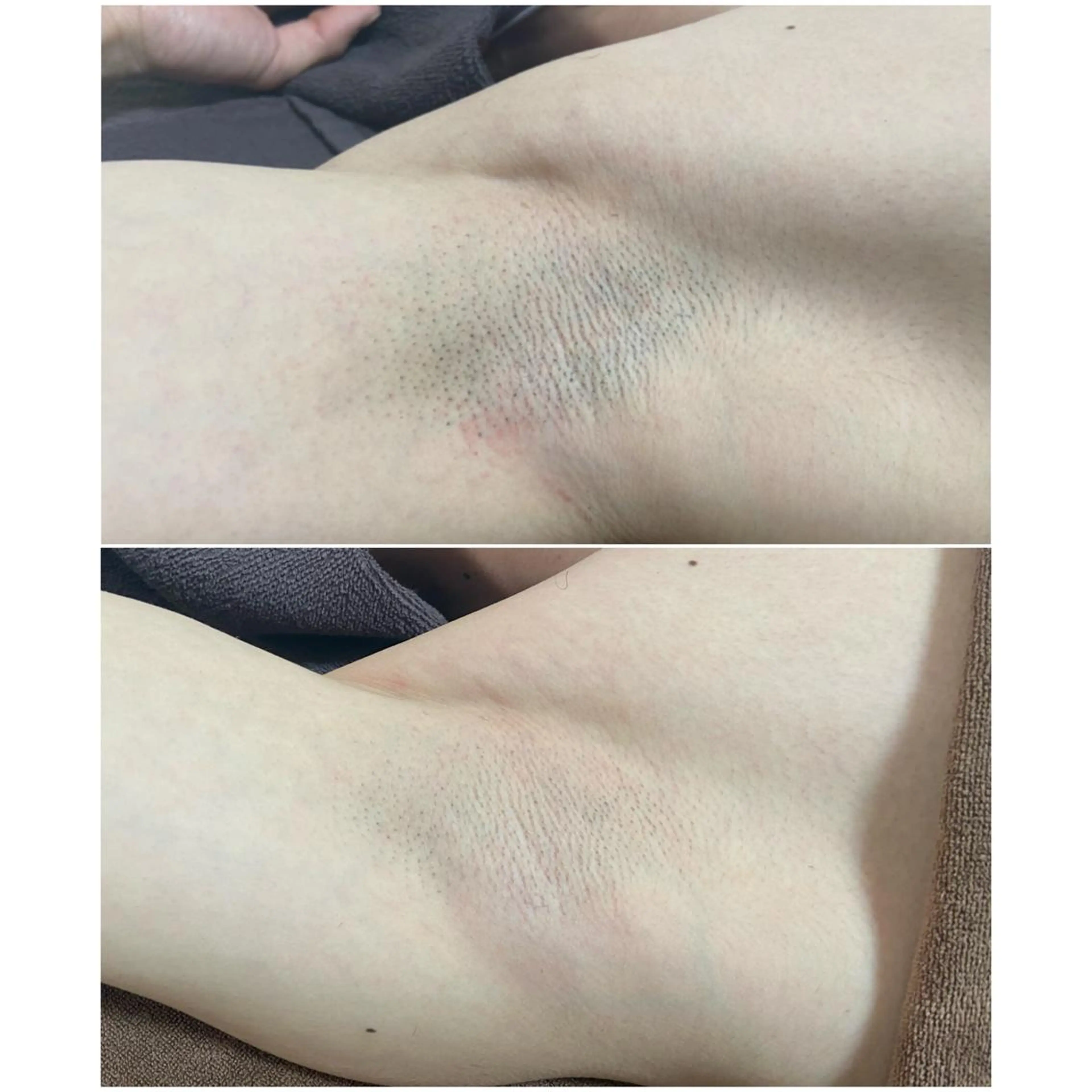 メンズ 都度払い制脱毛サロンBe Charm所属・Be Charm 山﨑のエステ・リラクイメージ