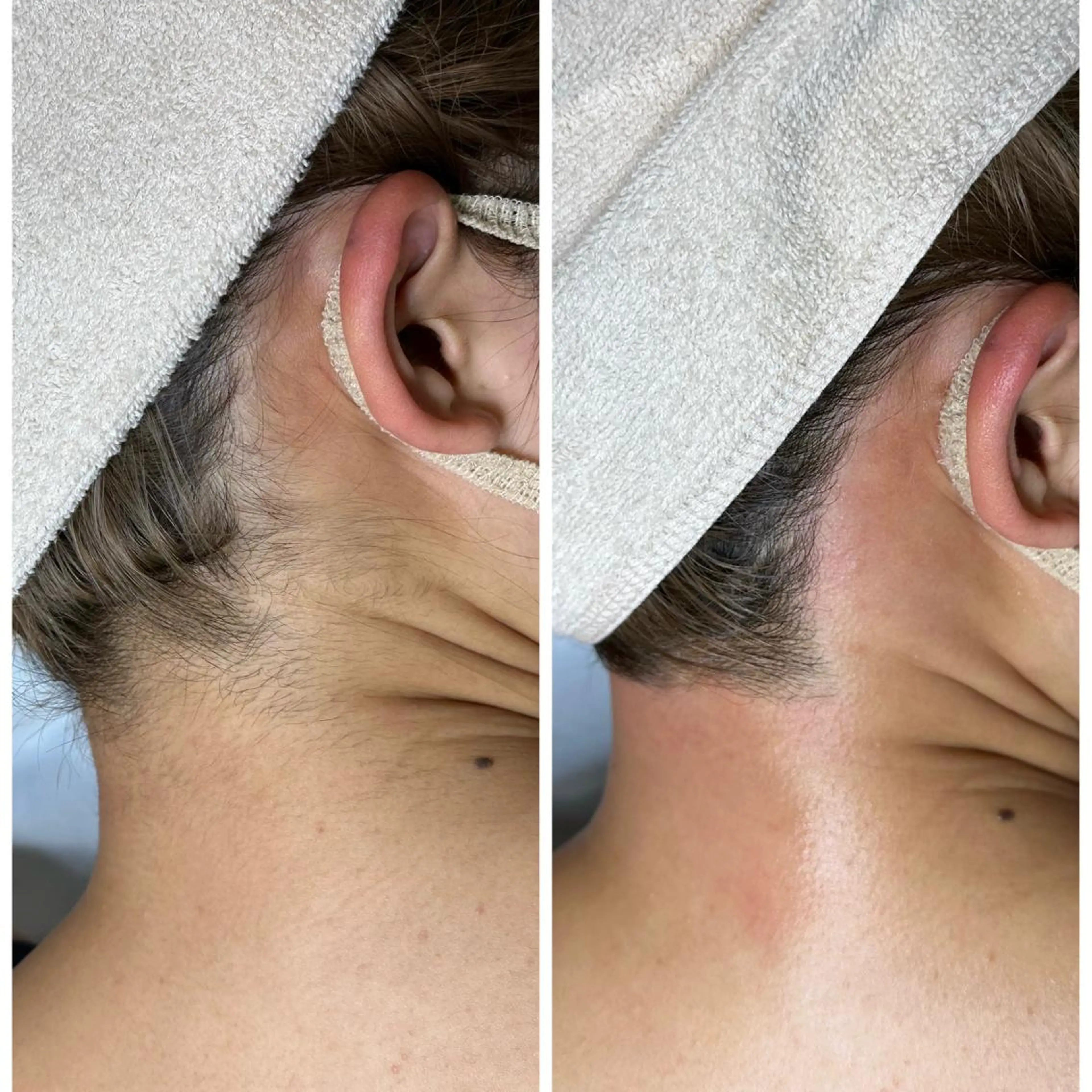 脱毛 WAX＆光脱毛 ESTHERIAのエステ・リラクイメージ