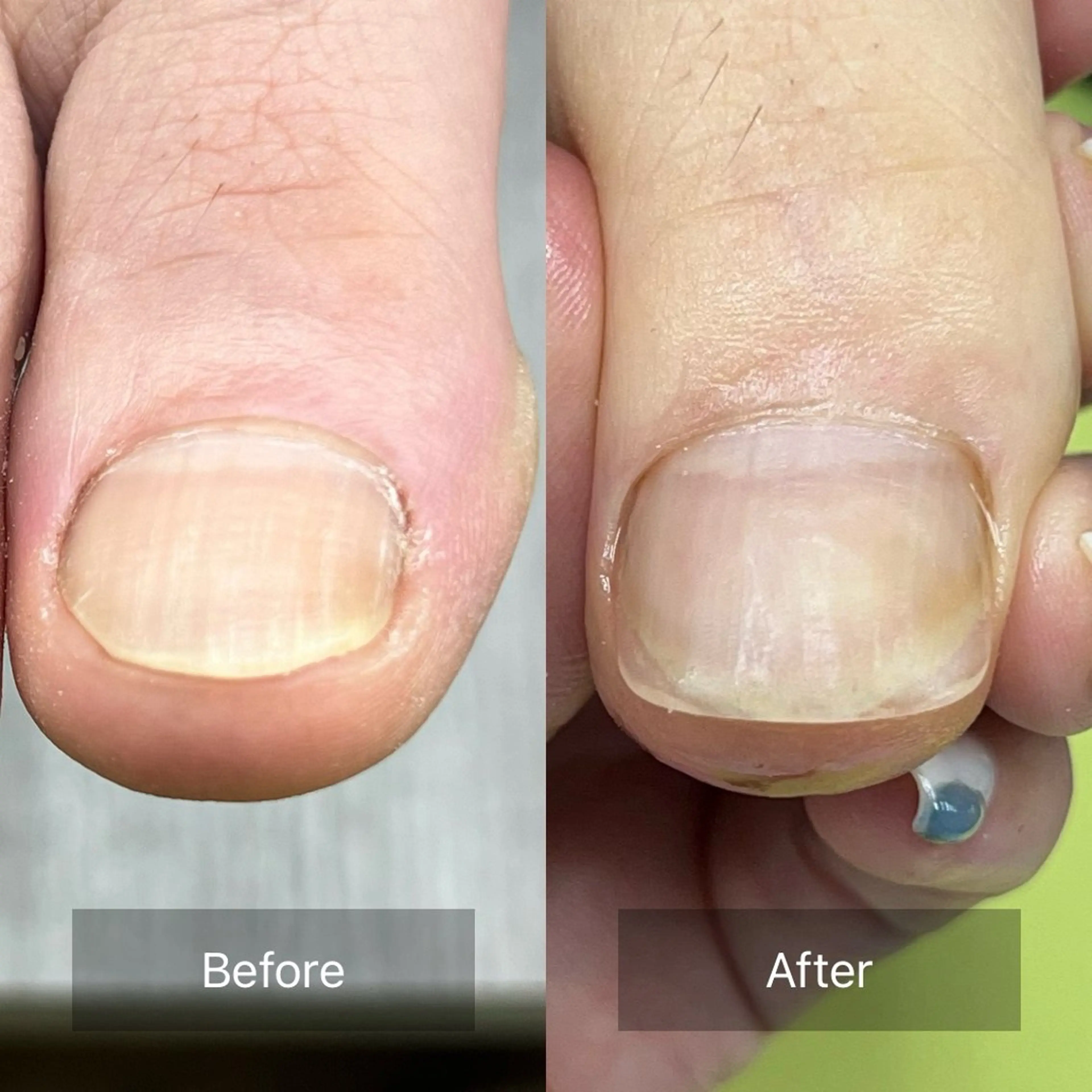 ネイル Belulu所属・Belulu ベルルのネイルデザイン