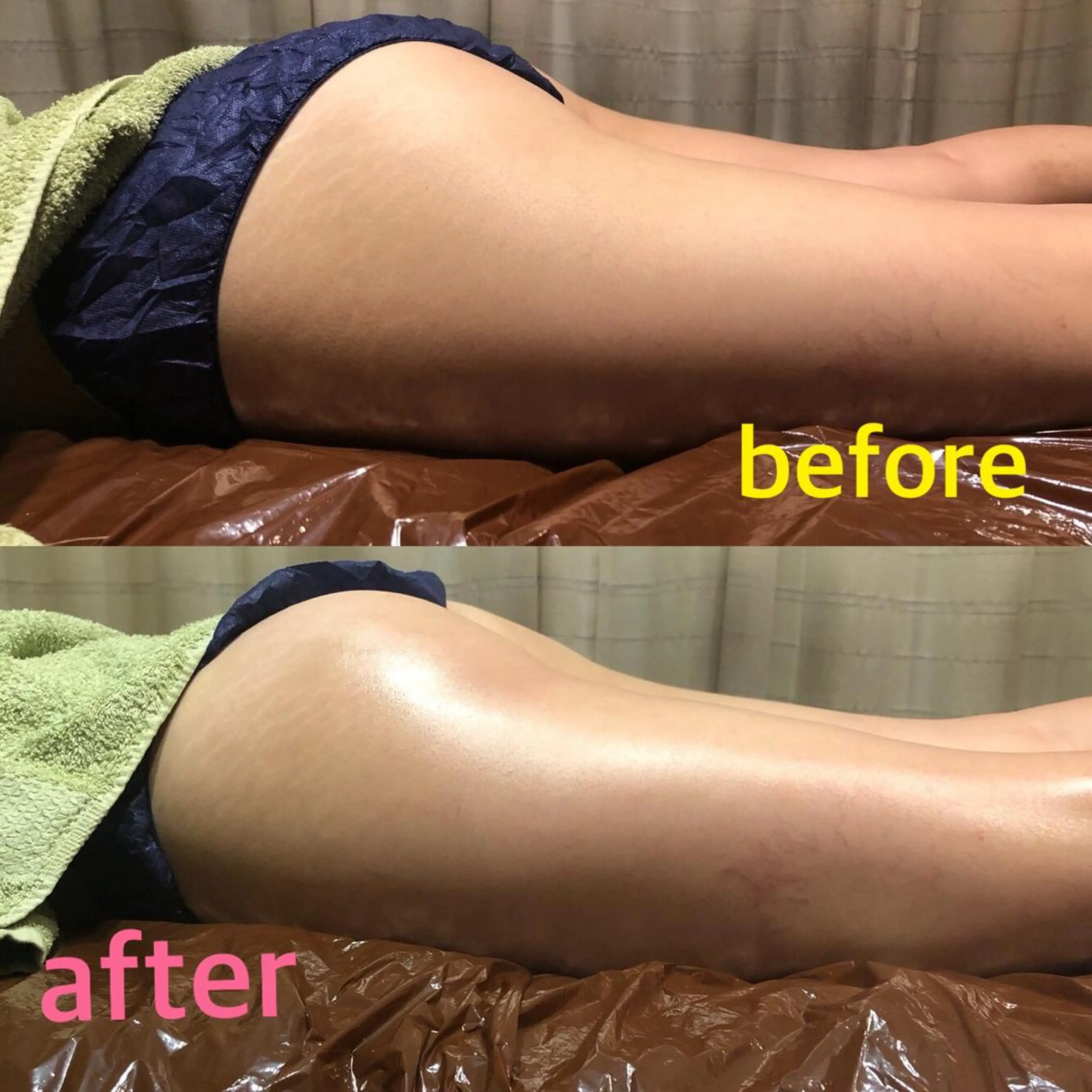 エステ ル・プランタン所属・ル・プランタン 小藪沙織のエステ・リラクイメージ