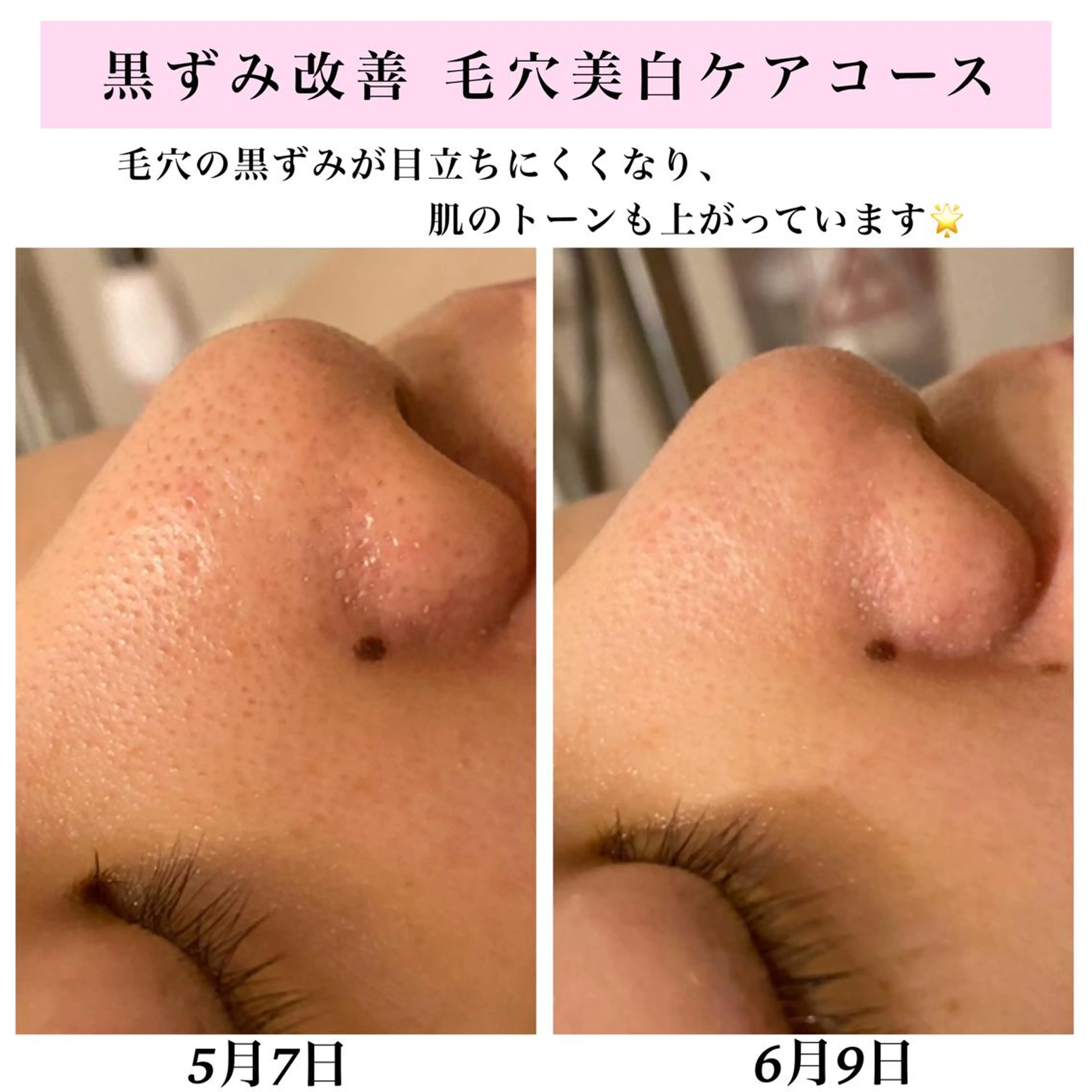 エステ リラク Bellesthe （ベルエステ）のエステ・リラクイメージ