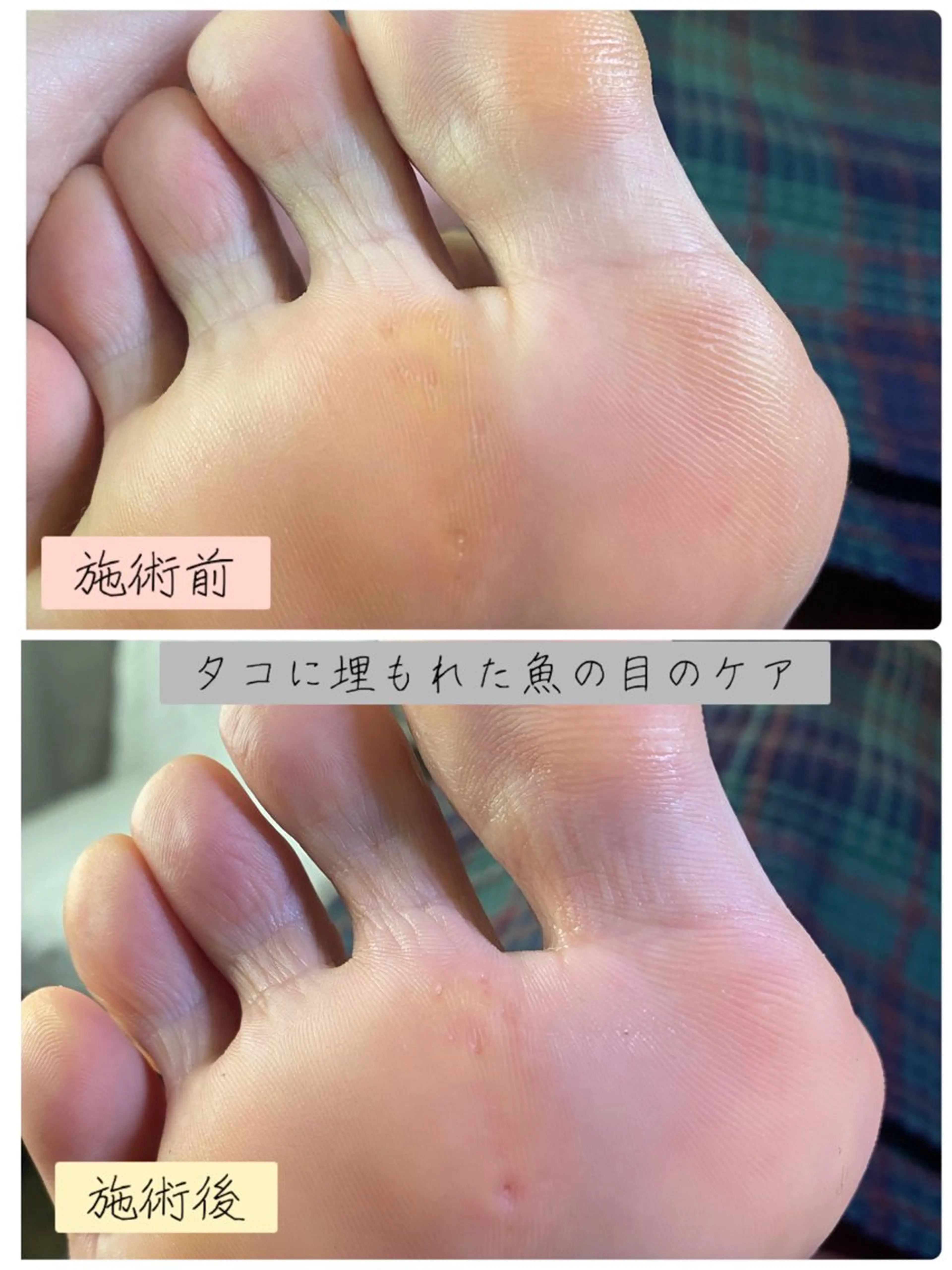 ネイル フットネイル フットネイル Studio Jivanのネイルデザイン