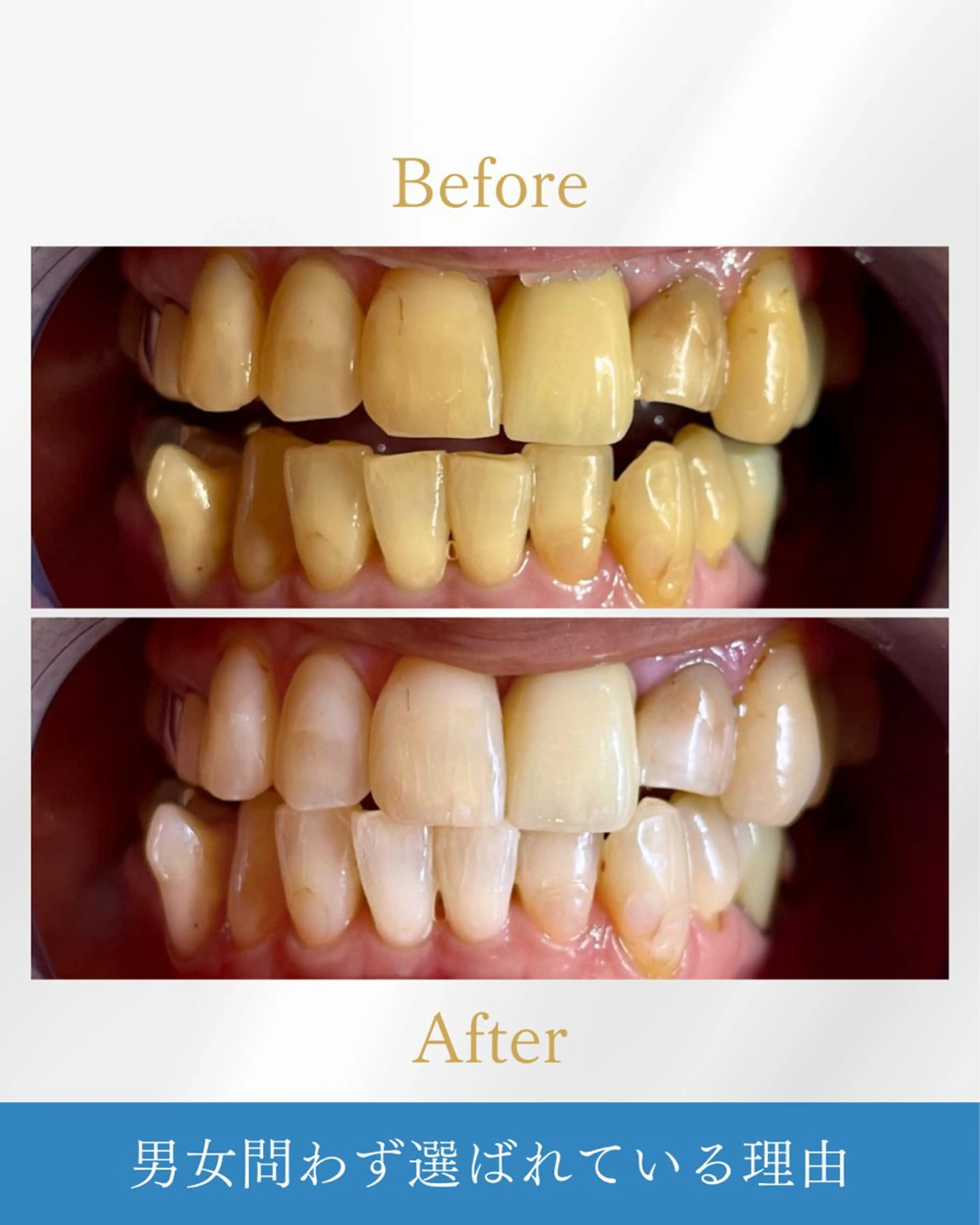 NAホワイトニング溝の口店所属・NAホワイトニング 溝の口店のエステ・リラクイメージ