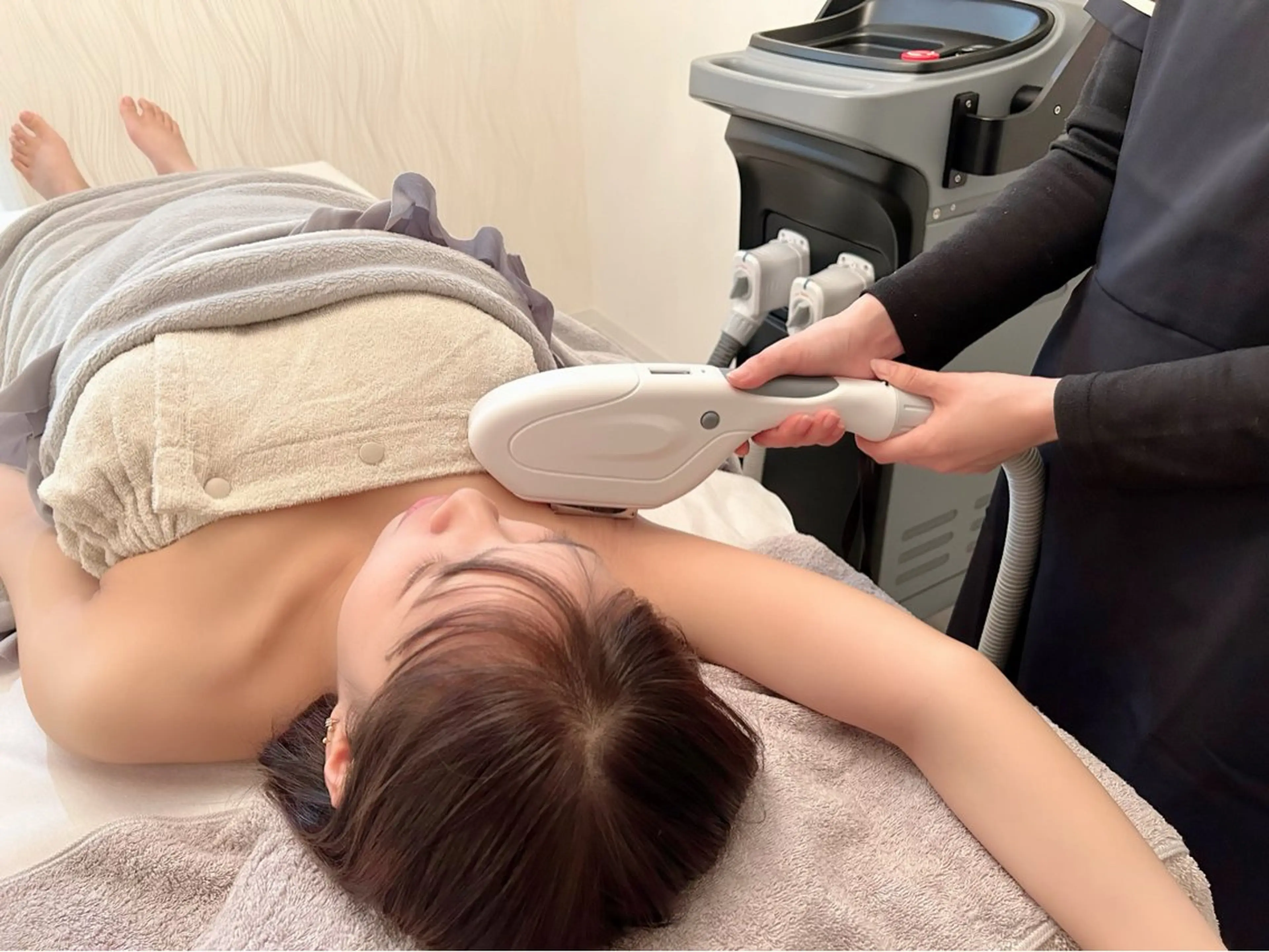 女性脇脱毛の写真