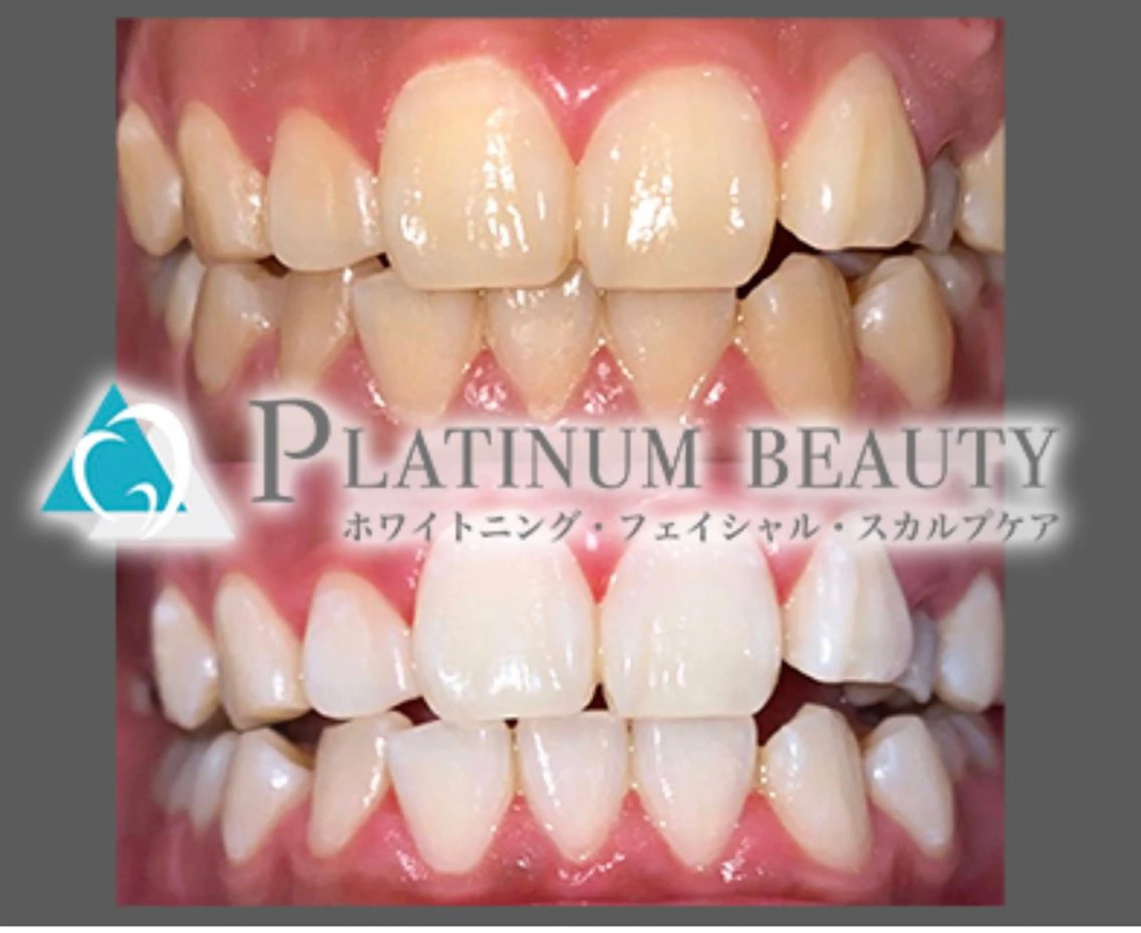 その他 プラチナムビューティー川口店所属・プラチナム ビューティー川口店のその他イメージ