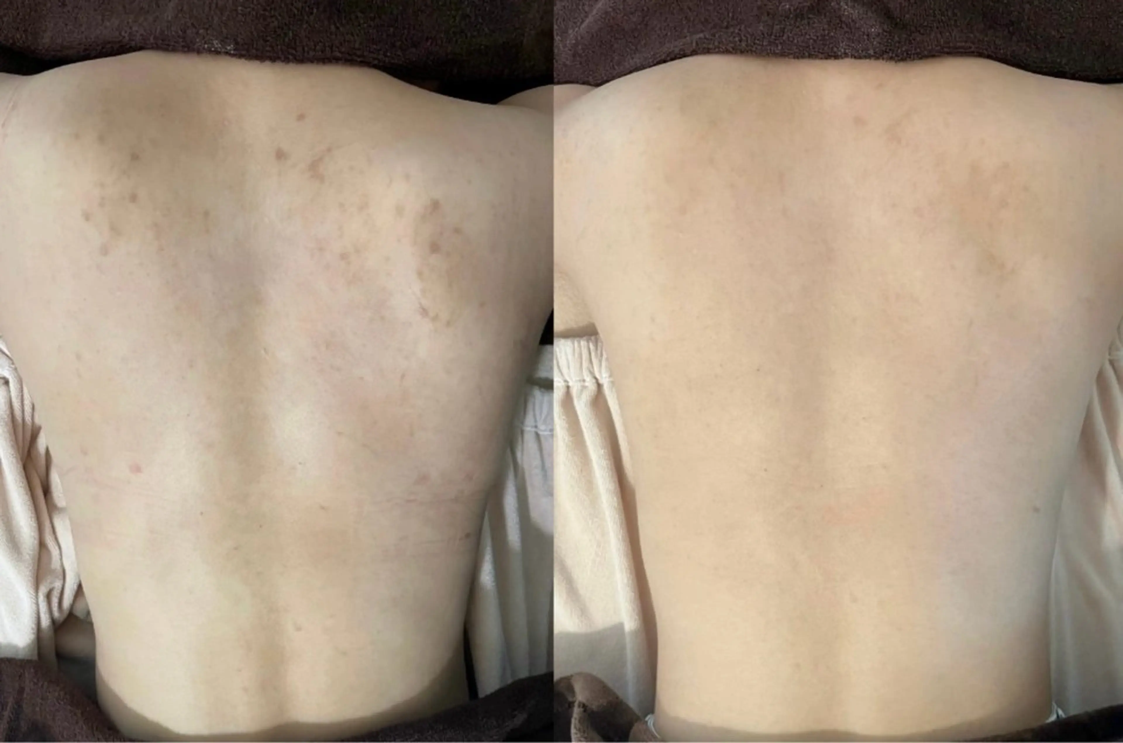 ENoa ハーブピーリング専門のエステ・リラクイメージ