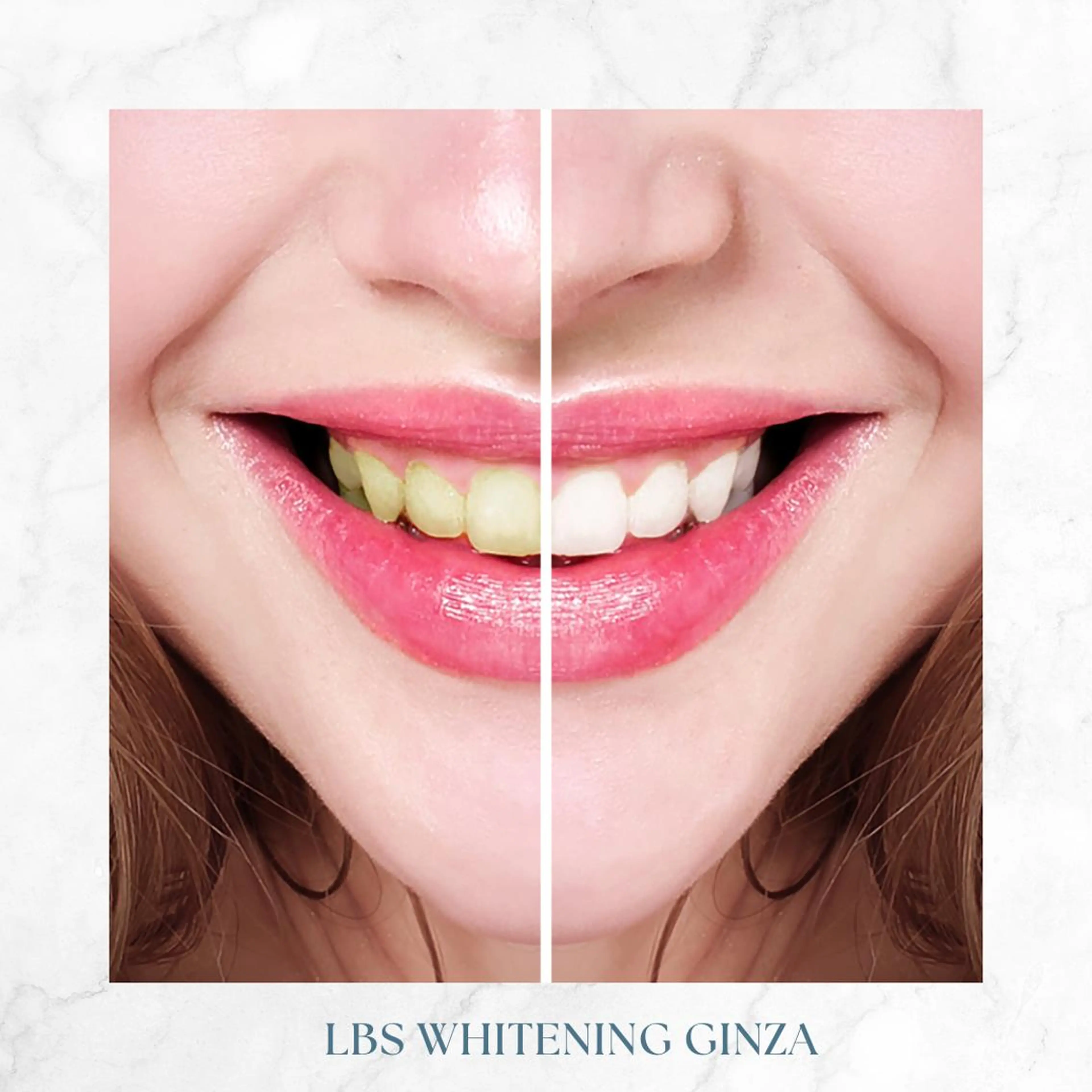 ミディアム メンズ カラー LBSホワイトニング 銀座店💎公式のその他イメージ
