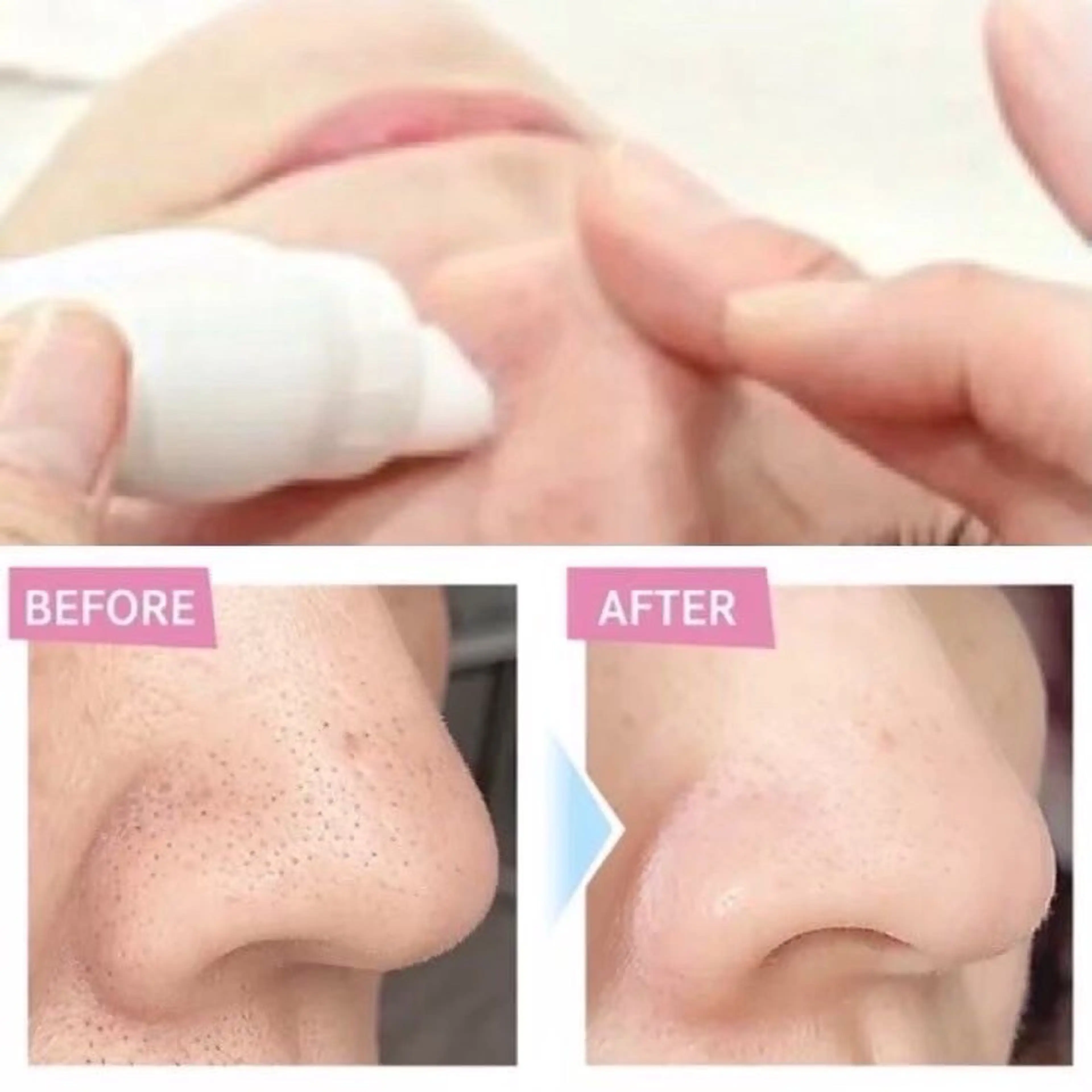 【再来】水素水毛穴洗浄×小顔リンパ🩵肌荒れ、ニキビ、黒ずみ、毛穴ケア🩵の写真