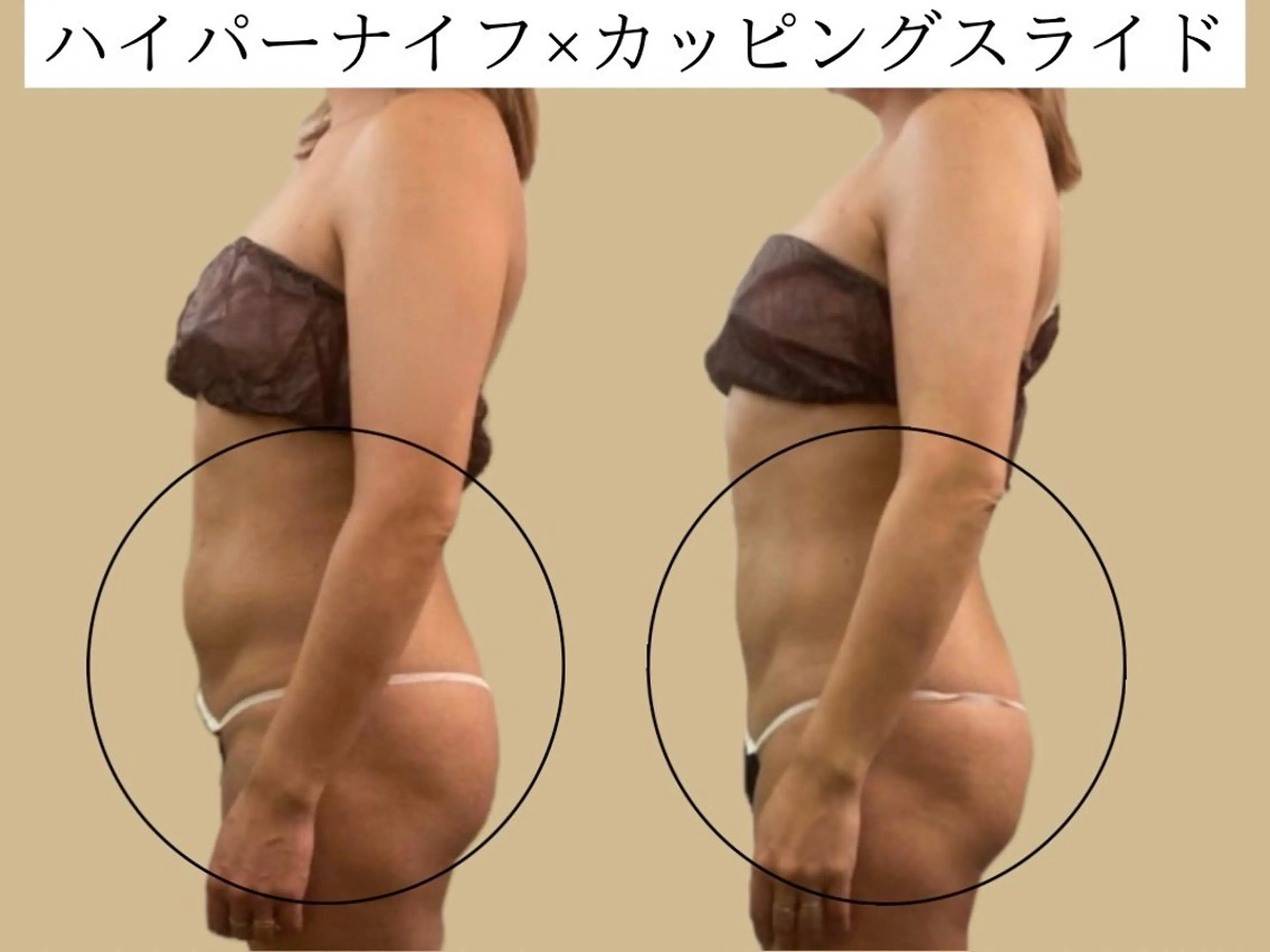 サロンハート浦和店所属・痩身小顔サロンハート 浦和店のエステ・リラクイメージ