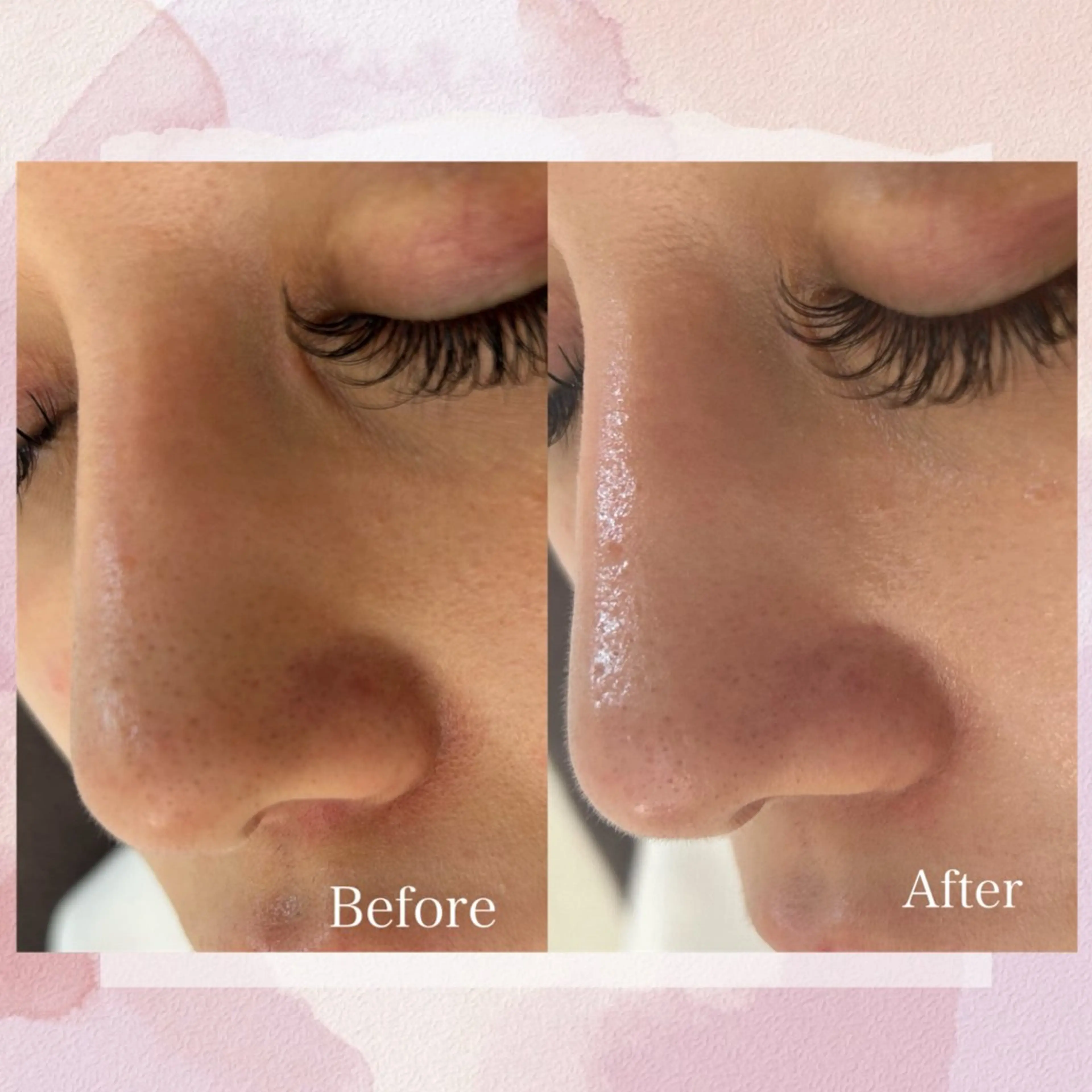 Belle  beauty  salon所属・Bellebeau tysalonのエステ・リラクイメージ