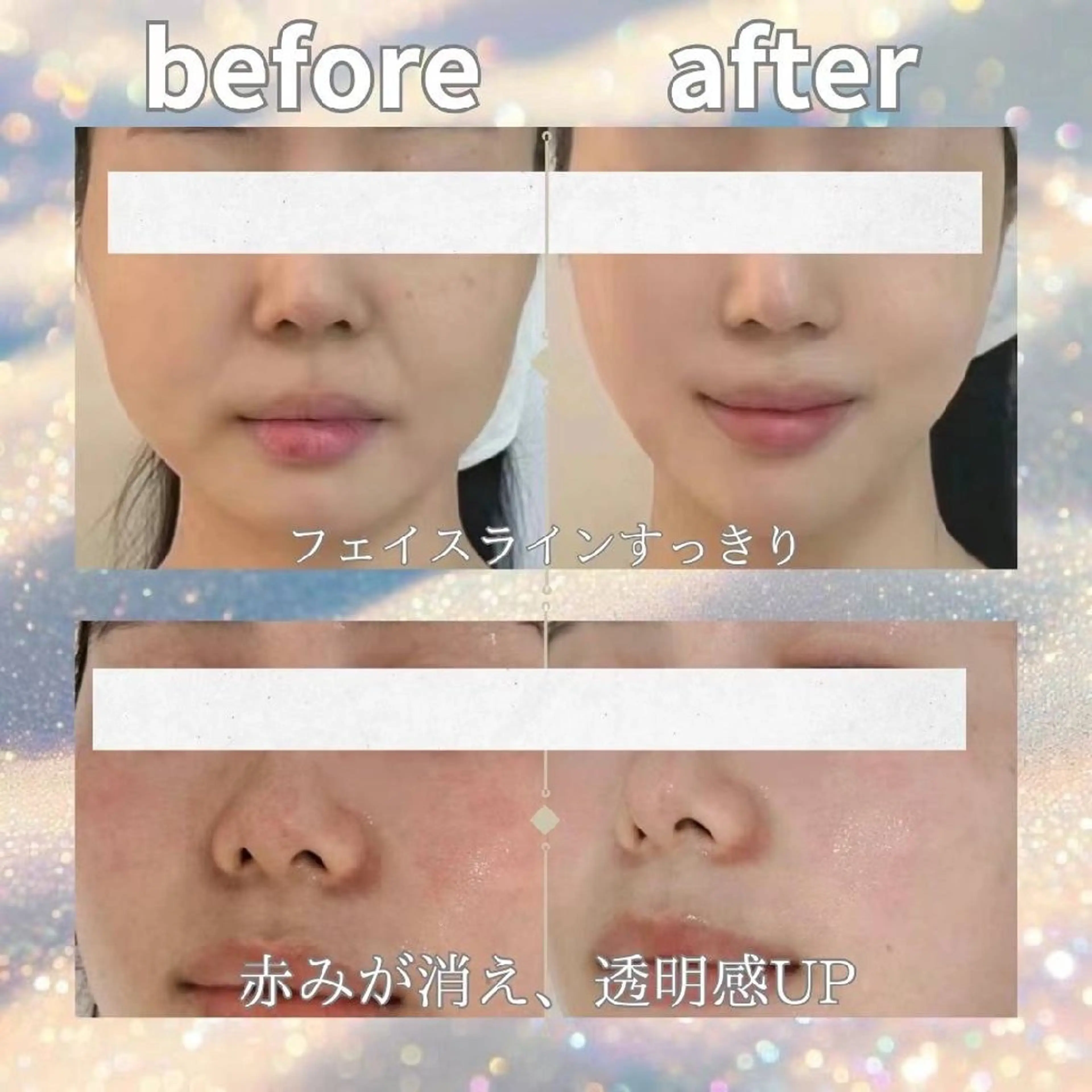 アイブロウ 眉毛ワックス脱毛 aliaハイフ&水光ジェットサロン所属・aliaハーブ水光店 エステティシャン募集のエステ・リラクイメージ