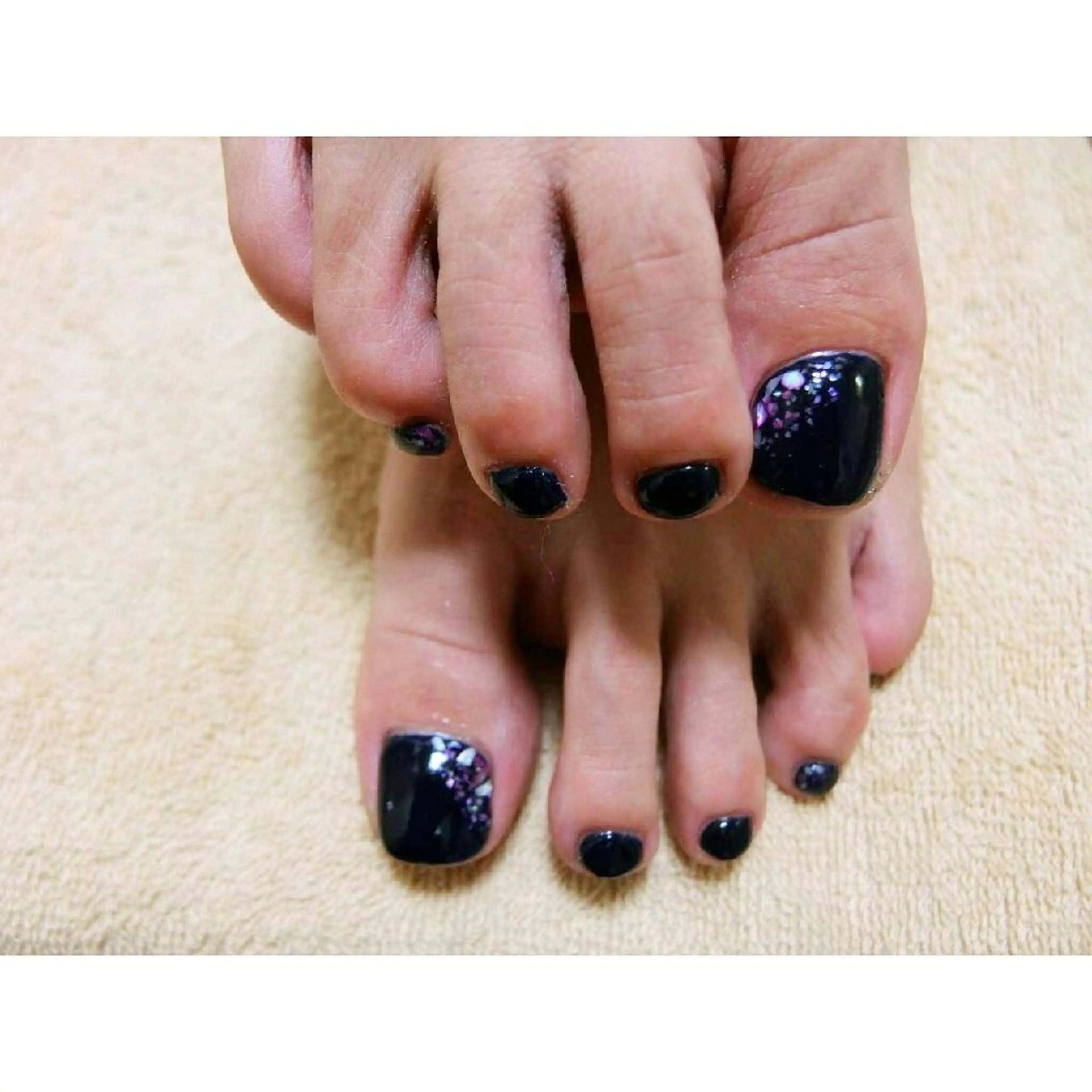 ネイル フットネイル シンプルネイル 痛ネイル/ワンホン/ フィルイン/長さだしのネイルデザイン