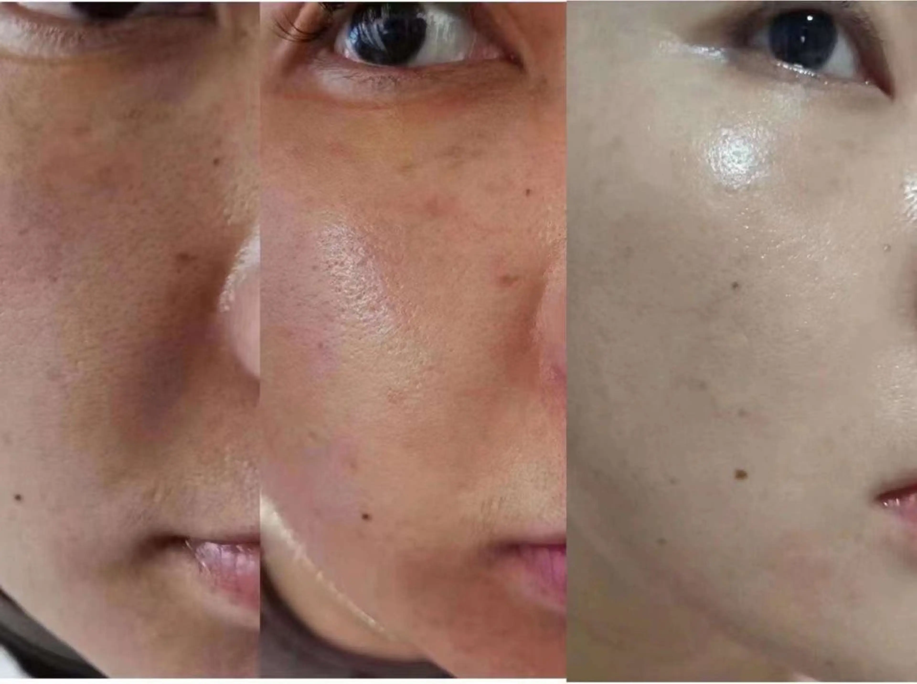 ショート カラー ネイル マツエク・マツパ 韓国風マツエク 韓国風ヘア 小顔カット 韓国ネイル エステ aliaハイフ&水光ジェットサロン所属・aliaハーブ水光店 エステティシャン募集のエステ・リラクイメージ