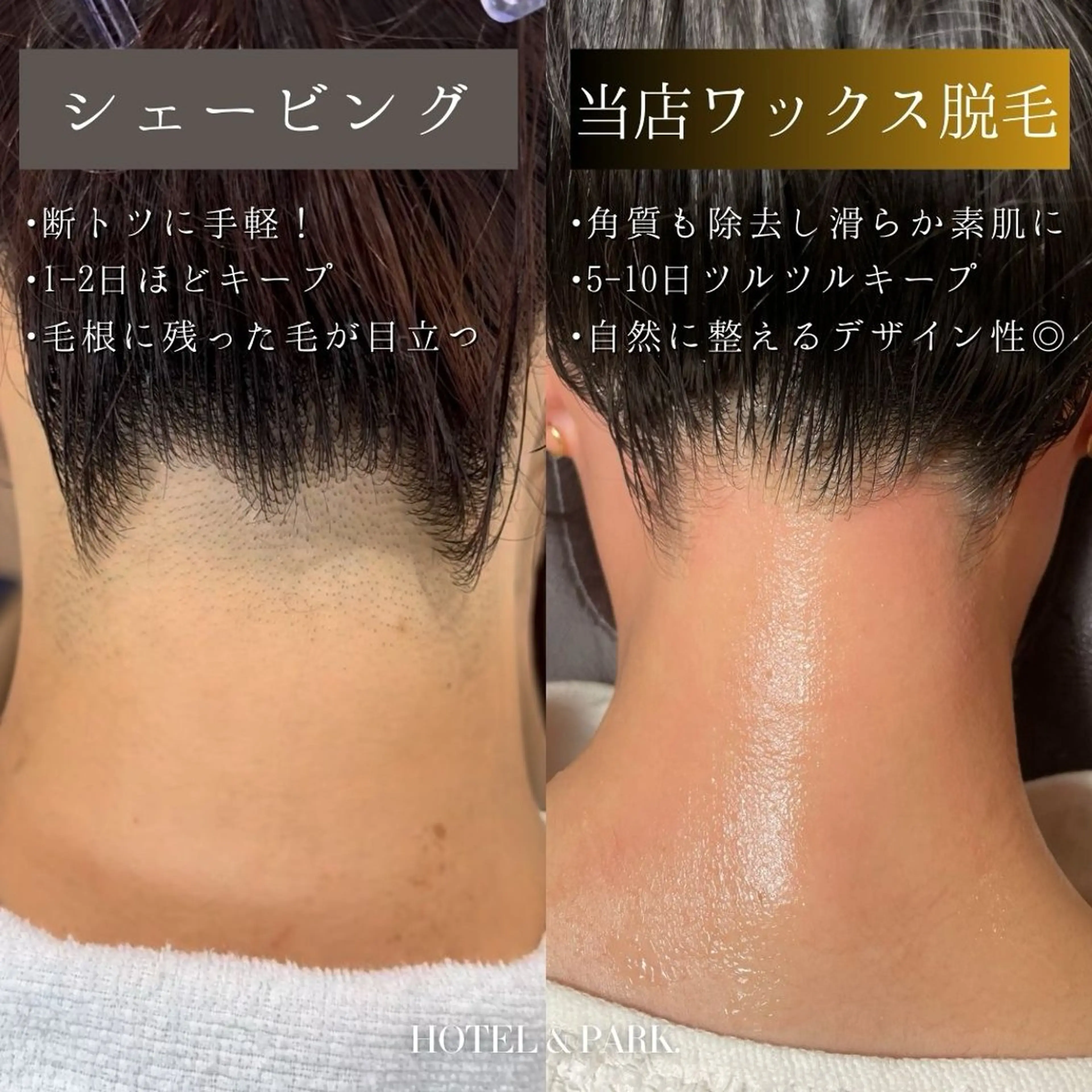 HOTEL&PARK . ワックス脱毛のエステ・リラクイメージ